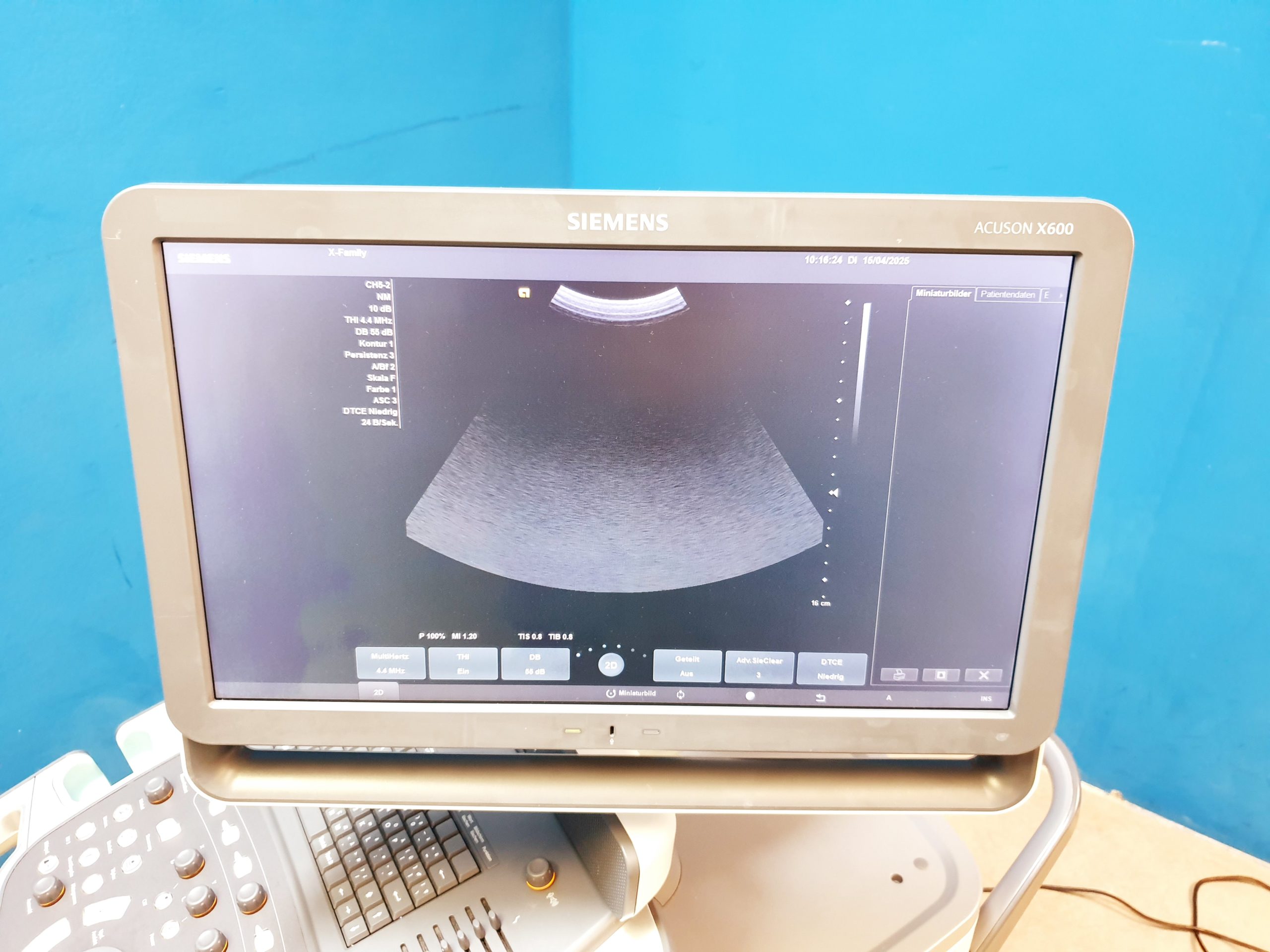 Siemens Acuson X600 Farbdoppler + CH5-2 Konvex + VF12-4 Linear thumbnail 12