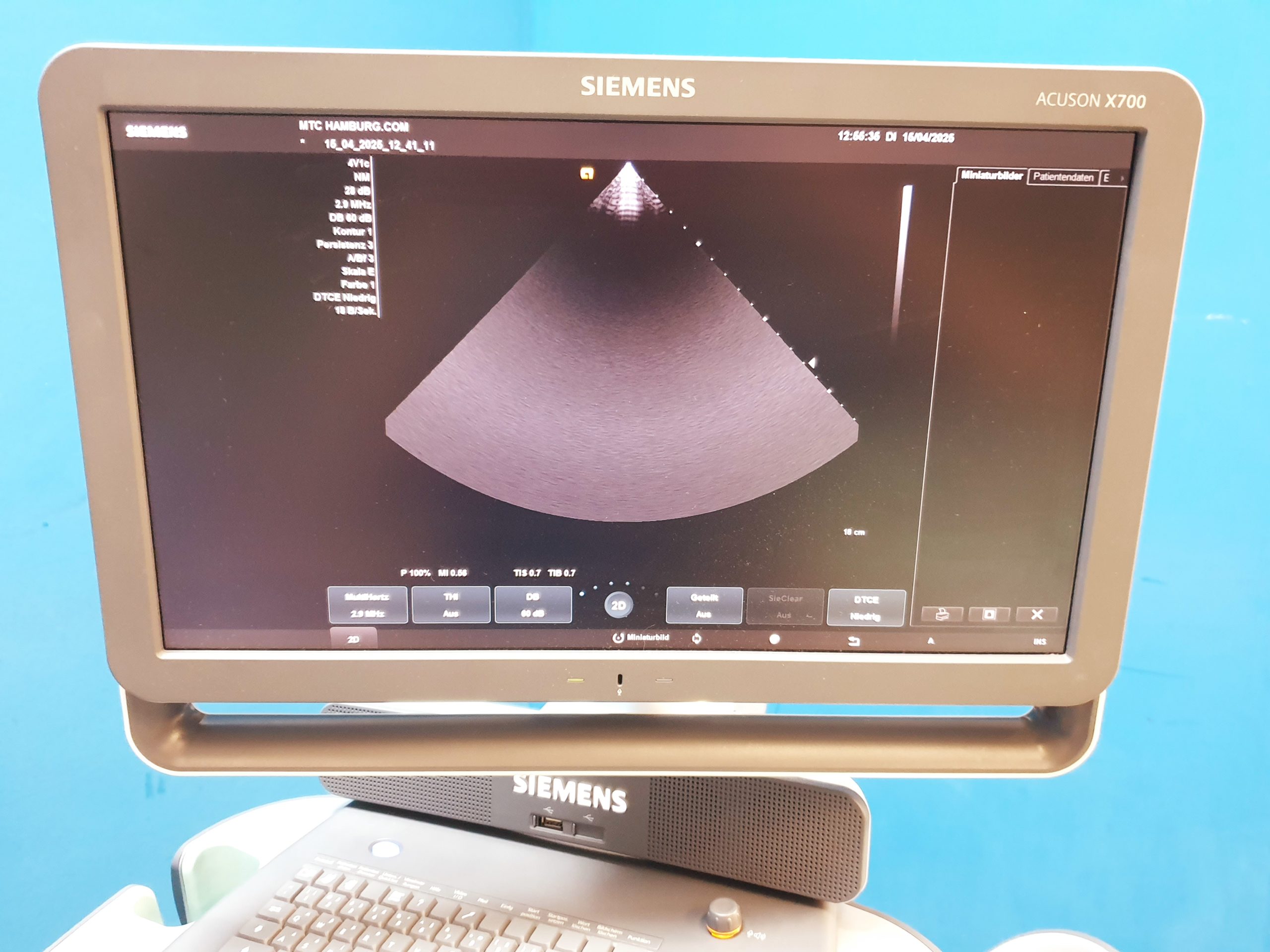 Siemens Acuson X700 Farbdoppler + 6C2 + 4V1c Echo thumbnail 6