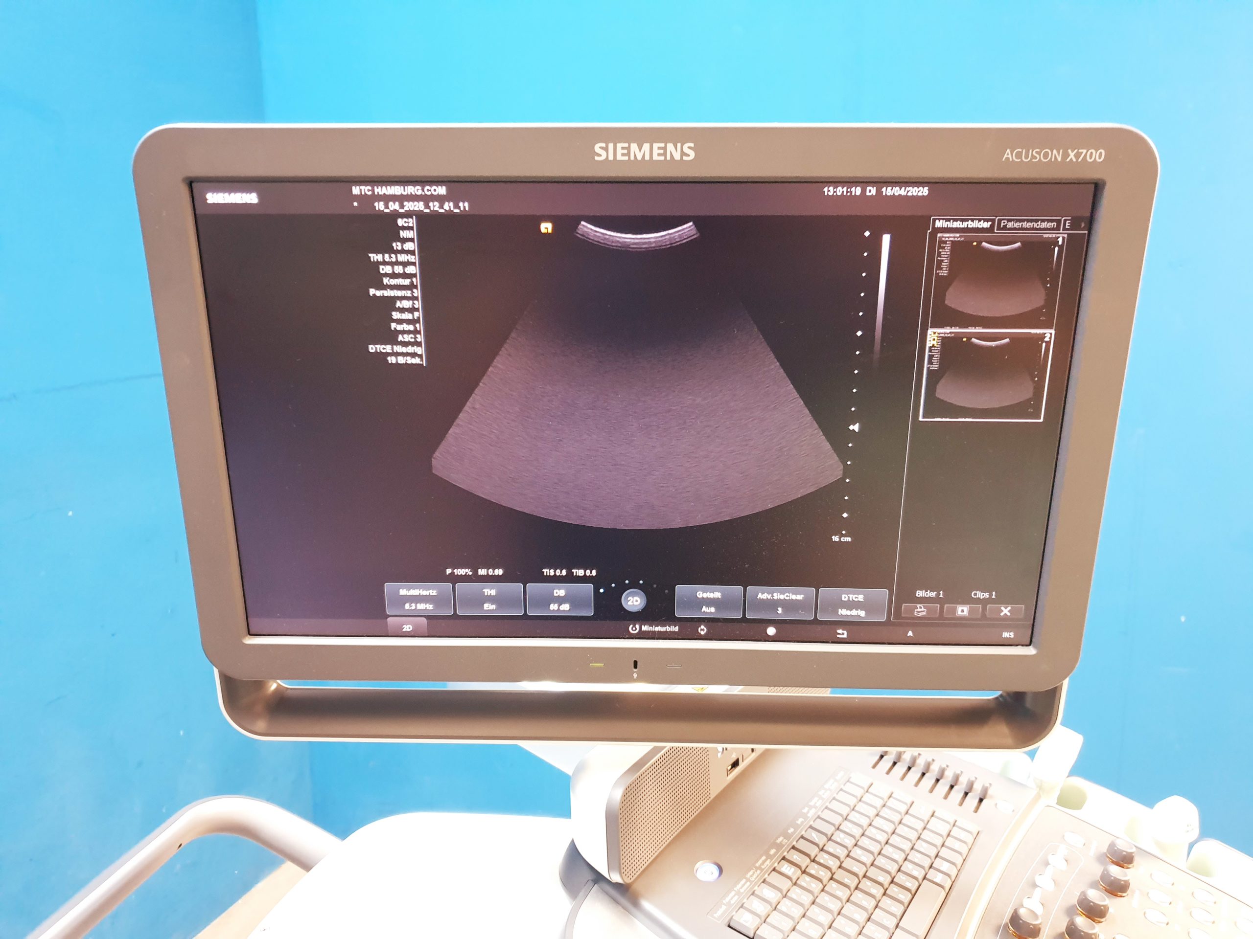Siemens Acuson X700 Farbdoppler + 6C2 + 4V1c Echo thumbnail 10