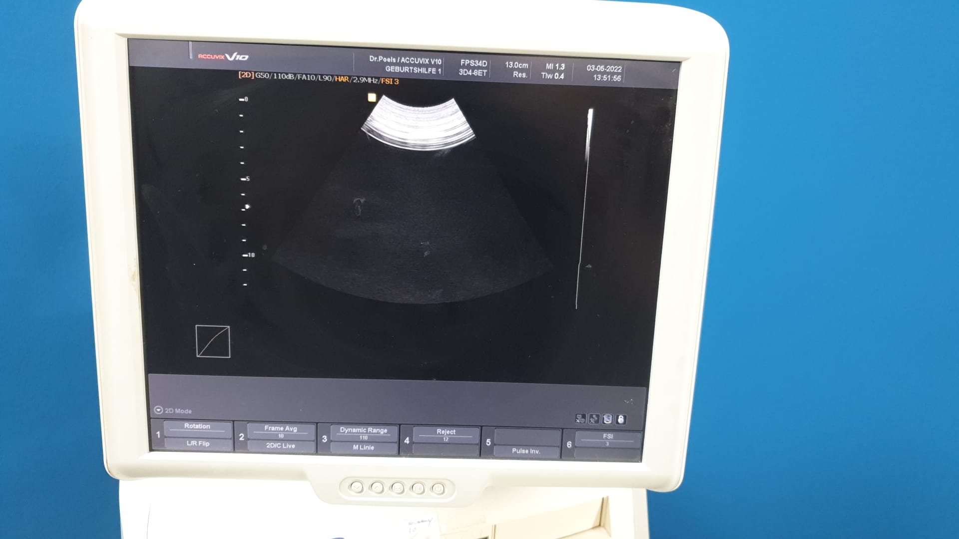 Sonoace ACCUVIX V10 // V 10 3D 4-8ET + L5-13IS + EC4-9IS // 3D/4D thumbnail 6