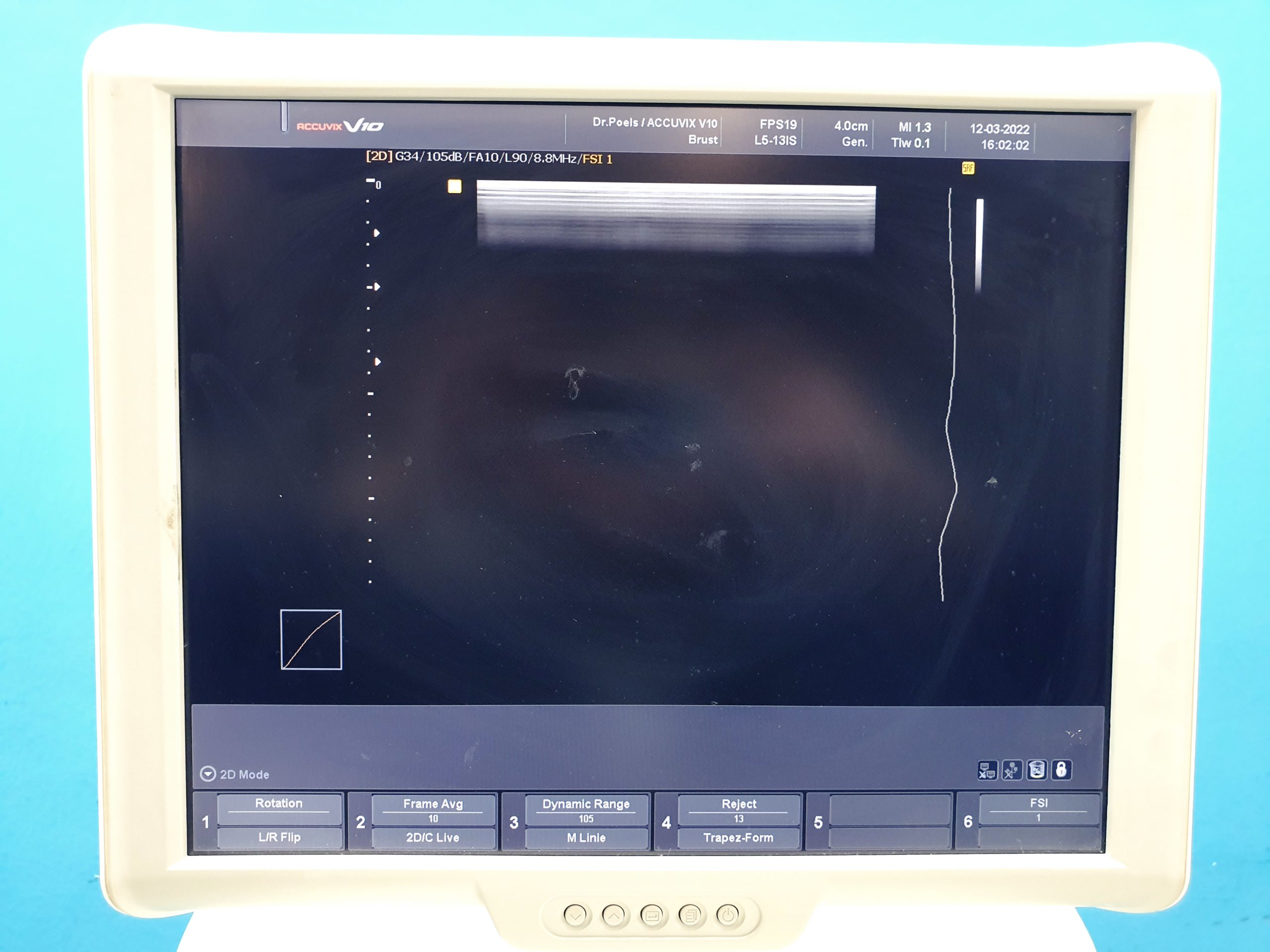 Sonoace ACCUVIX V10 // V 10 3D 4-8ET + L5-13IS + EC4-9IS // 3D/4D thumbnail 9