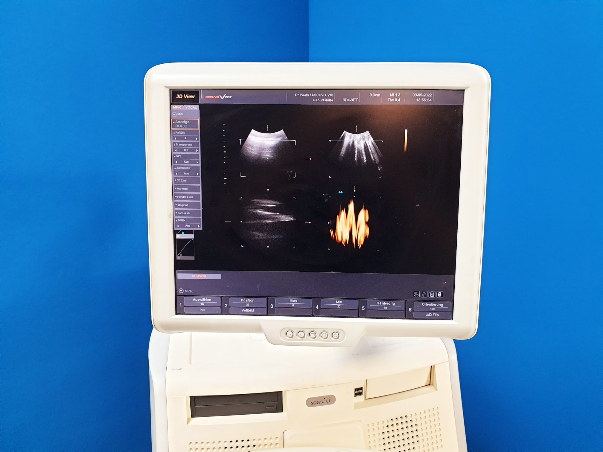 Sonoace ACCUVIX V10 // V 10 3D 4-8ET + L5-13IS + EC4-9IS // 3D/4D thumbnail 11