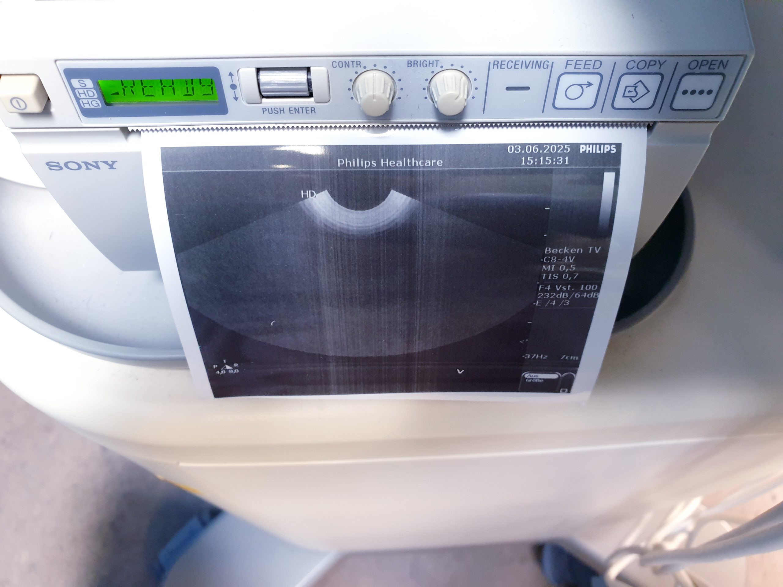 Philips HD 5 HD5 + C5-2 + C8-4v + L12-3 – Gynmaschine Farbdoppler thumbnail 8