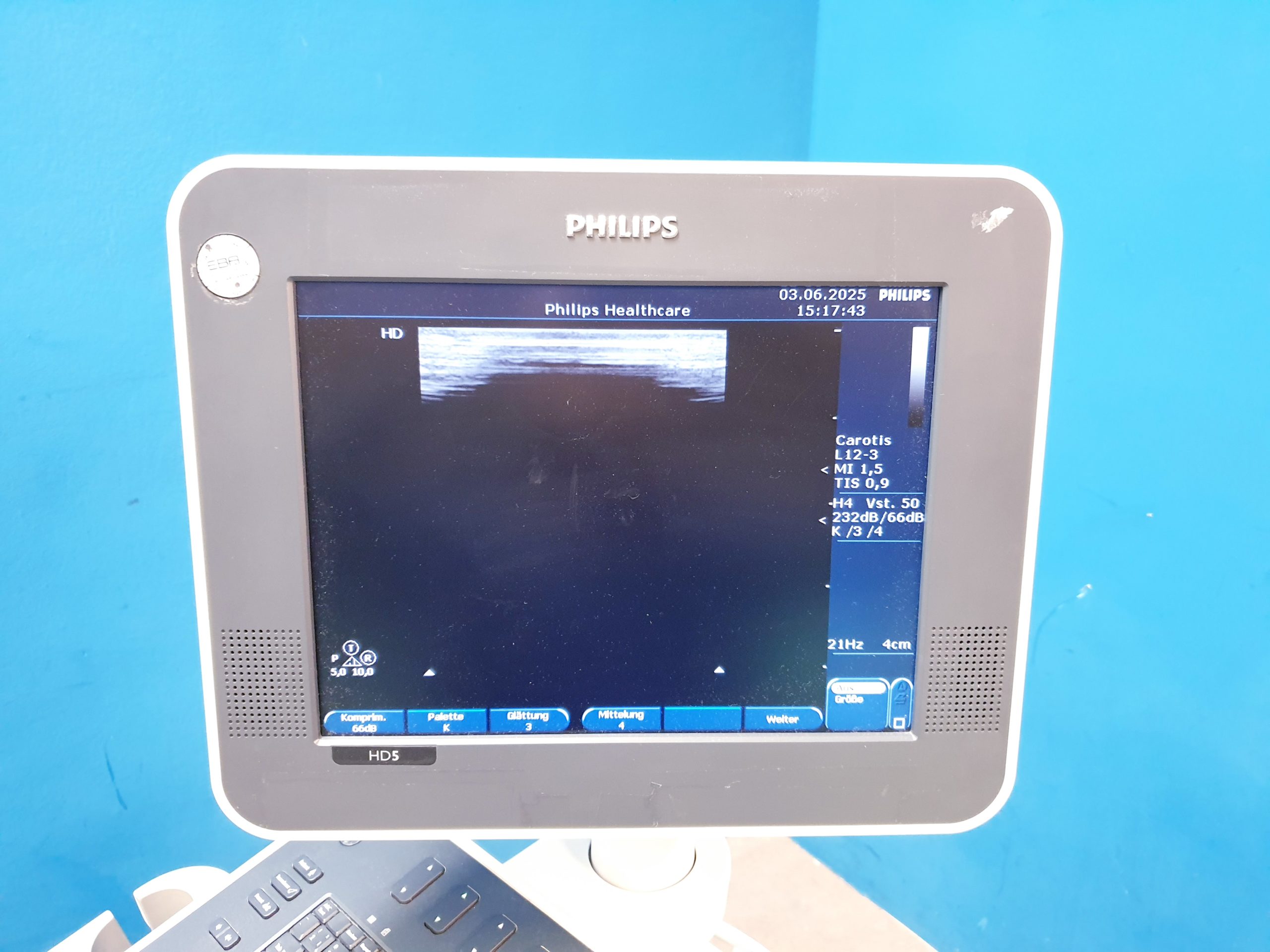 Philips HD 5 HD5 + C5-2 + C8-4v + L12-3 – Gynmaschine Farbdoppler thumbnail 12