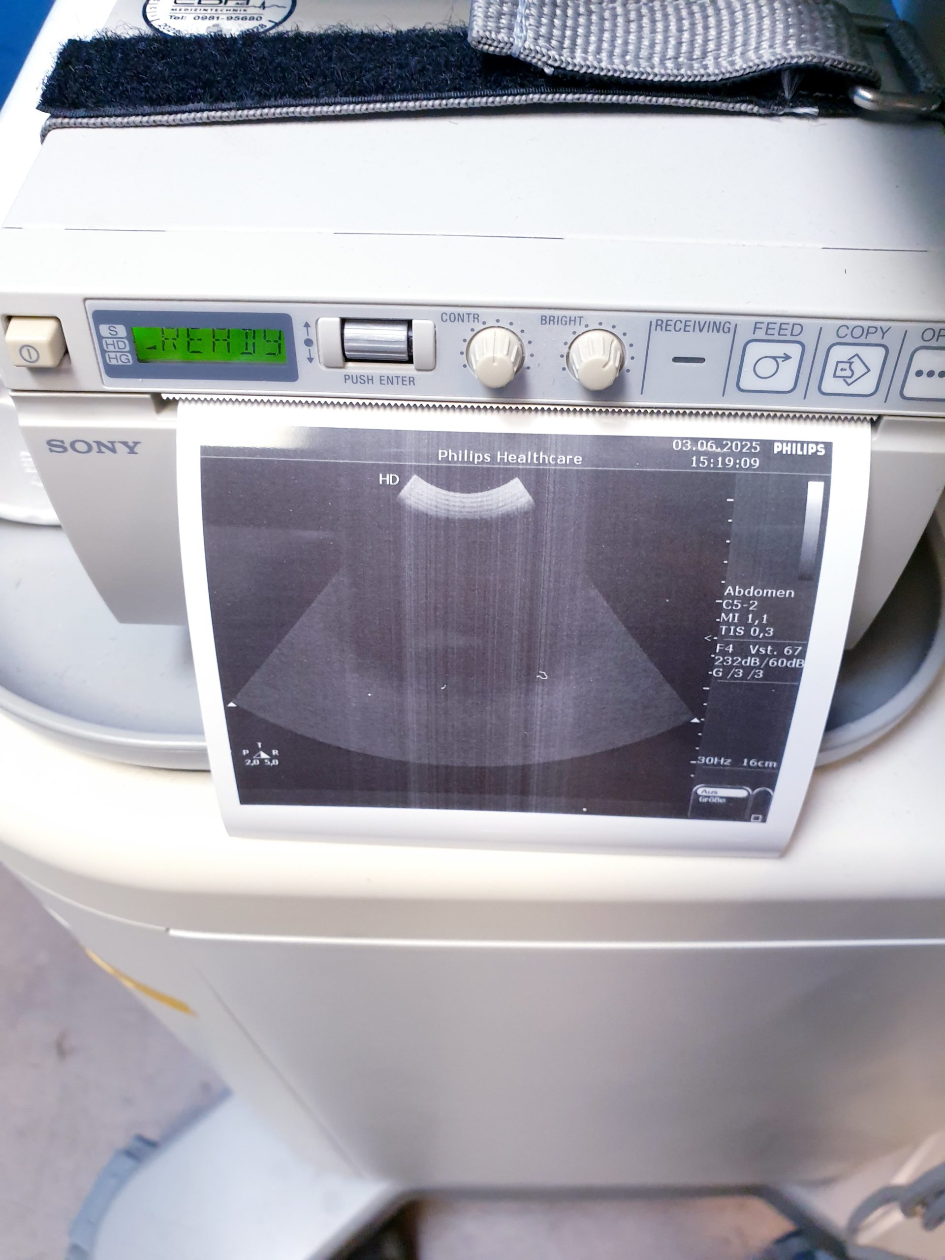 Philips HD 5 HD5 + C5-2 + C8-4v + L12-3 – Gynmaschine Farbdoppler thumbnail 17