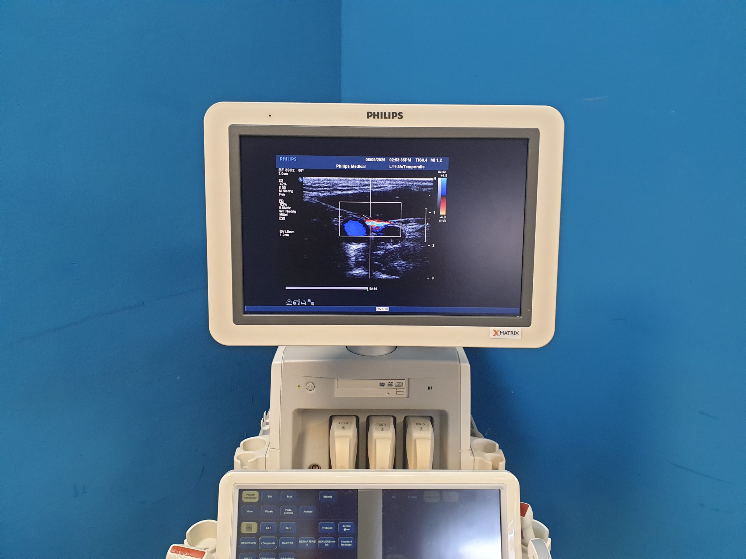 Philips iE33 – IE33 + S5-1 Echo + L11-3 Linear Sonde + Kardiomaschine + C5-1 Konvex Kardio Ultraschallgerät thumbnail 5