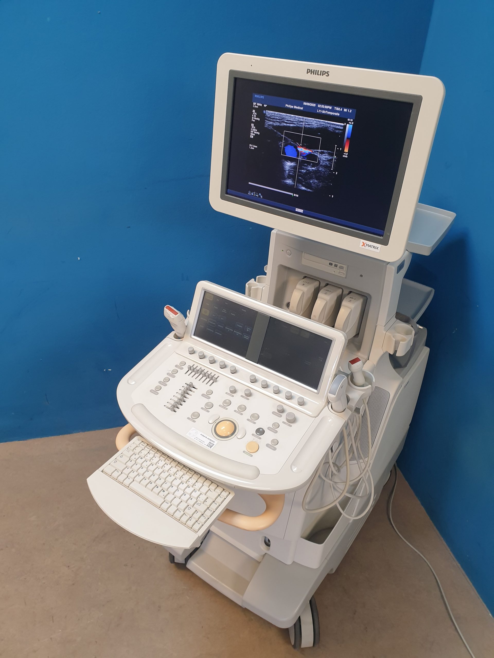 Philips iE33 – IE33 + S5-1 Echo + L11-3 Linear Sonde + Kardiomaschine + C5-1 Konvex Kardio Ultraschallgerät thumbnail 9