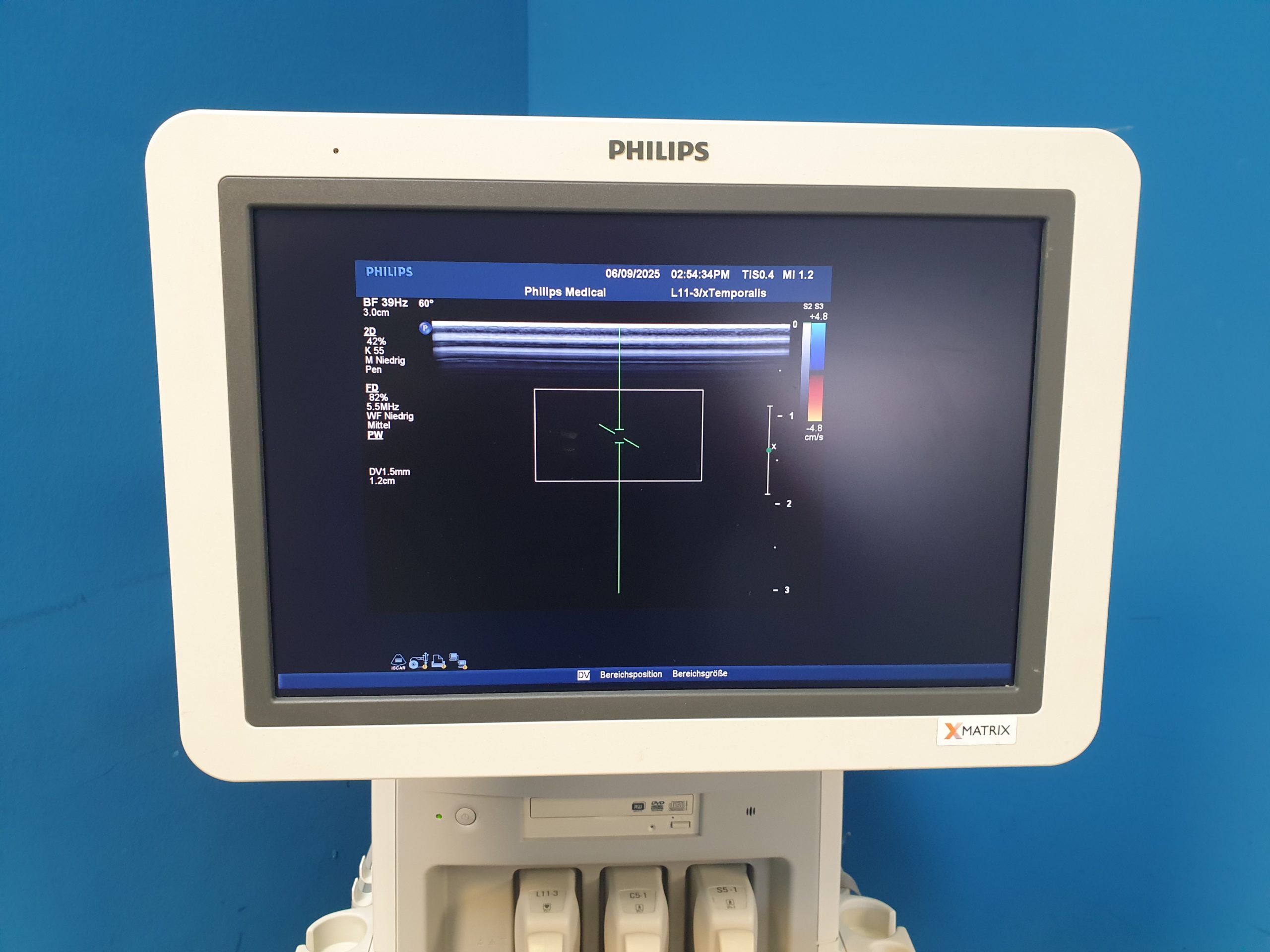 Philips iE33 – IE33 + S5-1 Echo + L11-3 Linear Sonde + Kardiomaschine + C5-1 Konvex Kardio Ultraschallgerät thumbnail 13