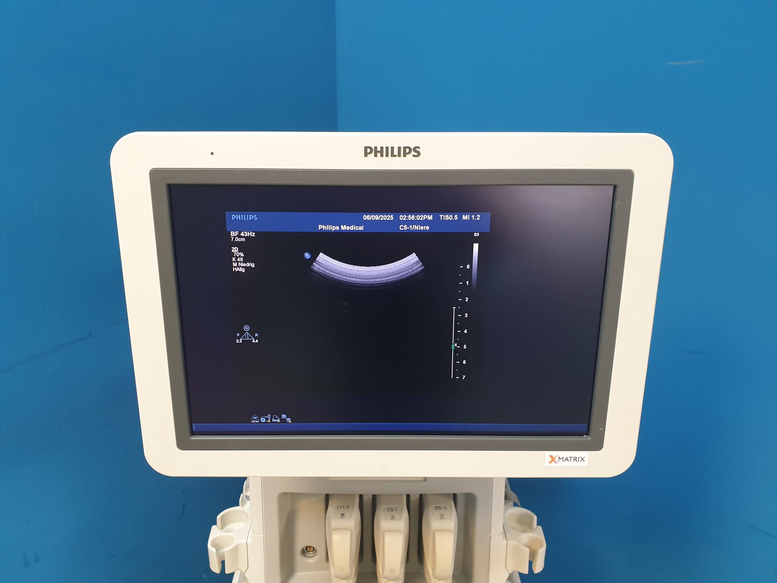 Philips iE33 – IE33 + S5-1 Echo + L11-3 Linear Sonde + Kardiomaschine + C5-1 Konvex Kardio Ultraschallgerät thumbnail 16