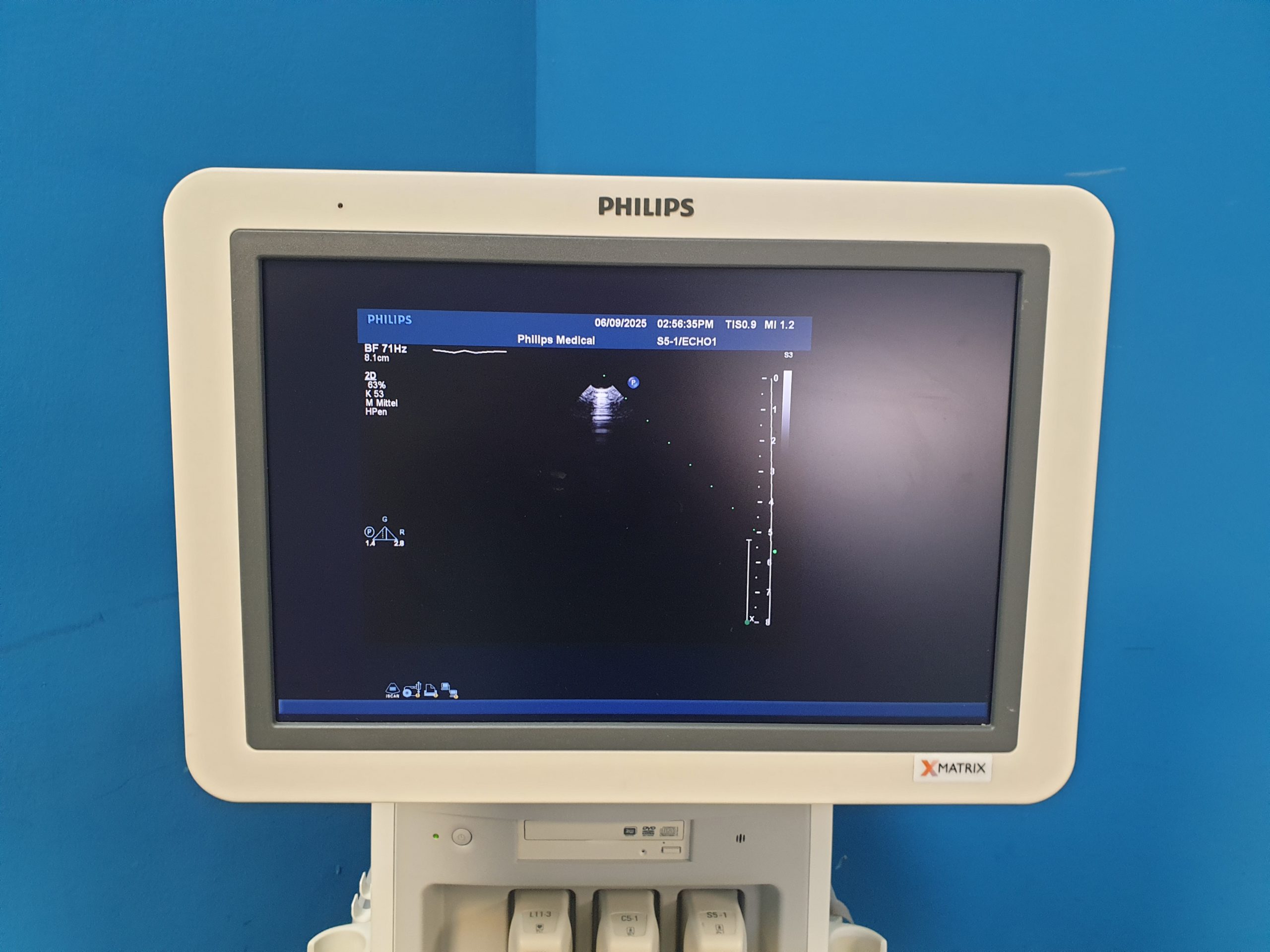 Philips iE33 – IE33 + S5-1 Echo + L11-3 Linear Sonde + Kardiomaschine + C5-1 Konvex Kardio Ultraschallgerät thumbnail 18