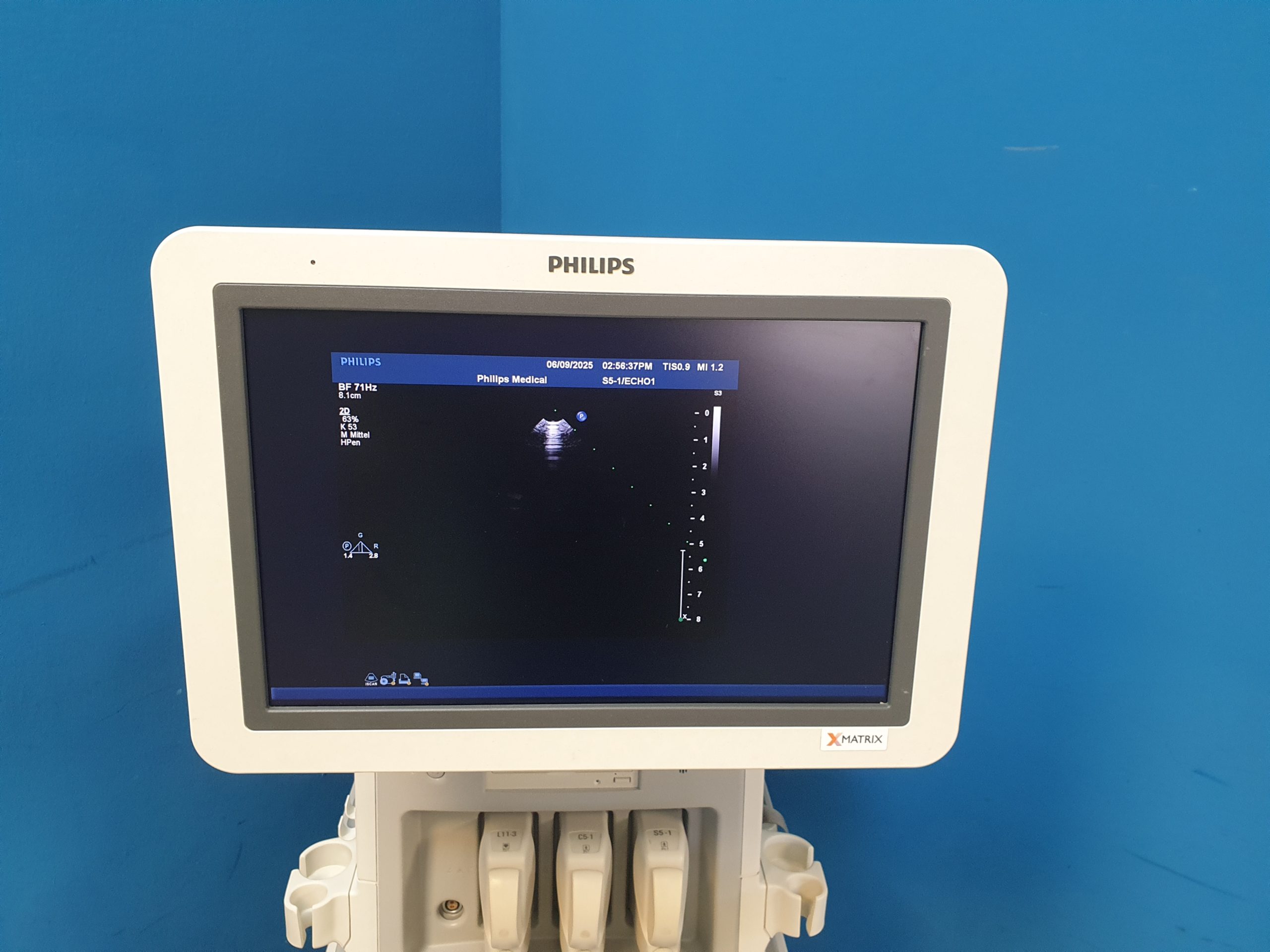 Philips iE33 – IE33 + S5-1 Echo + L11-3 Linear Sonde + Kardiomaschine + C5-1 Konvex Kardio Ultraschallgerät thumbnail 19