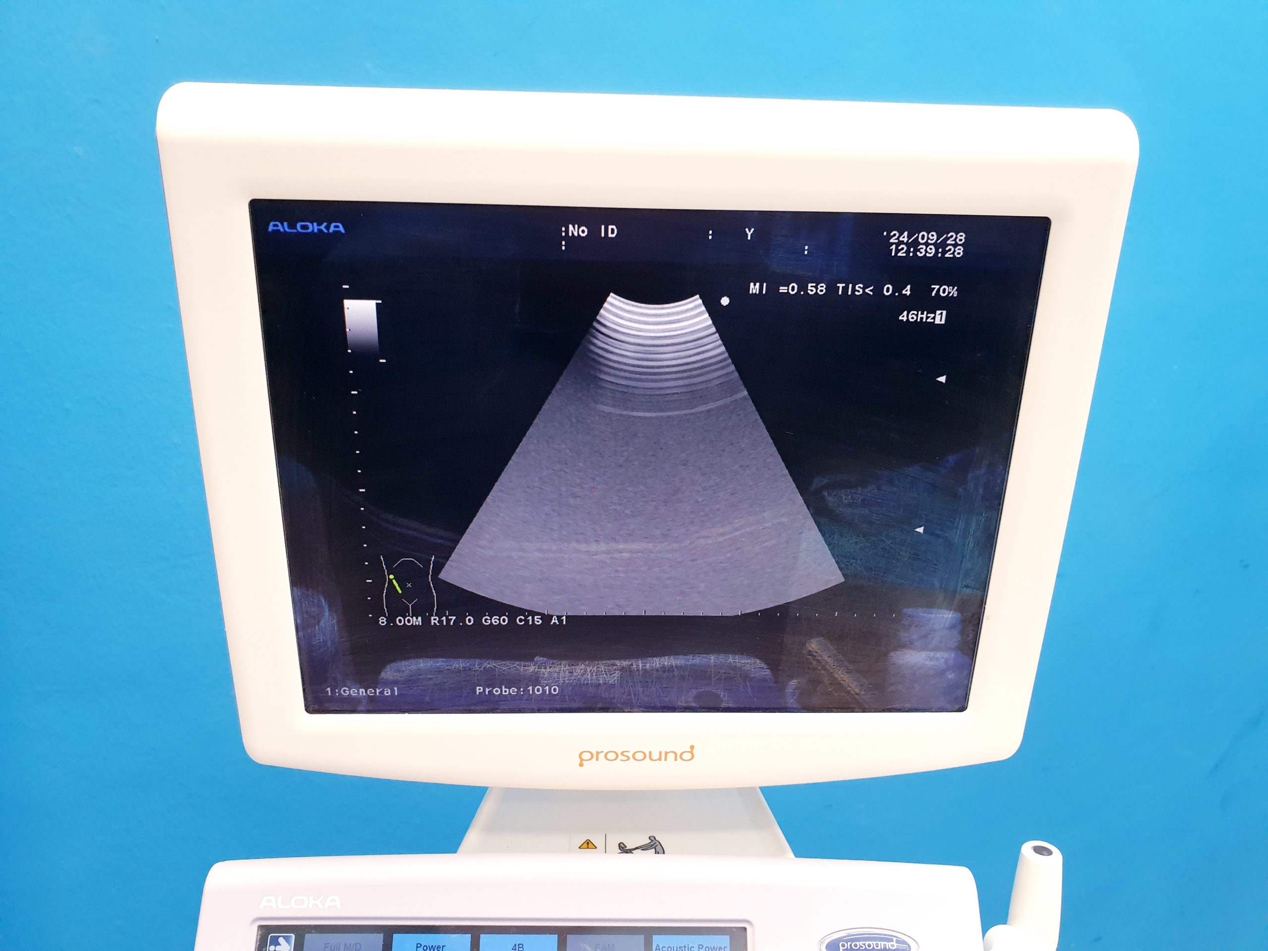 Aloka ASU-1010 Aloka ASU-1010 3D 4D Curved Array transducer thumbnail 3