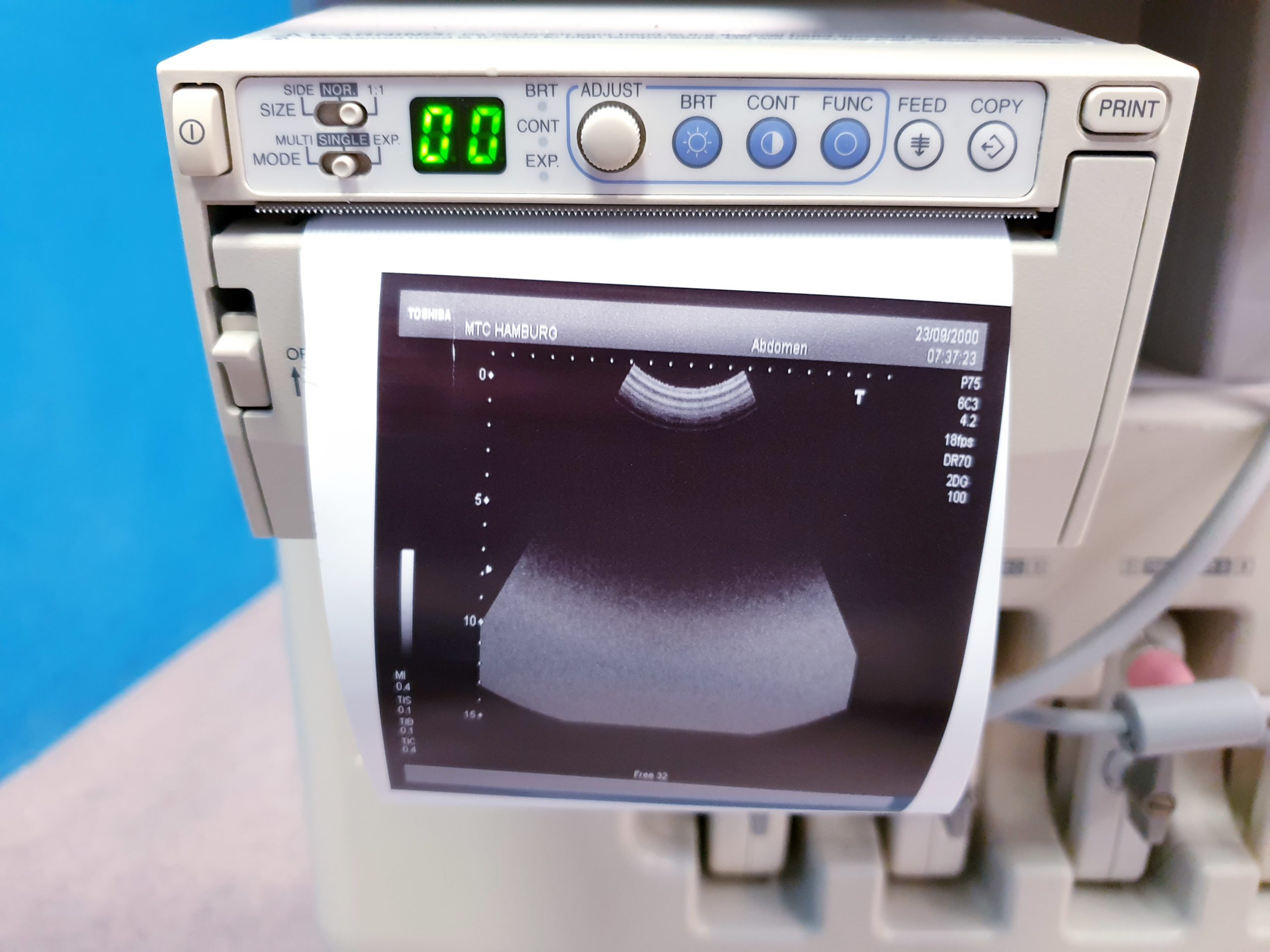 TOSHIBA NEMIO 20 SSA-550A Farbdoppler Ultraschallgerät mit 4 Sonden – und Printer thumbnail 8