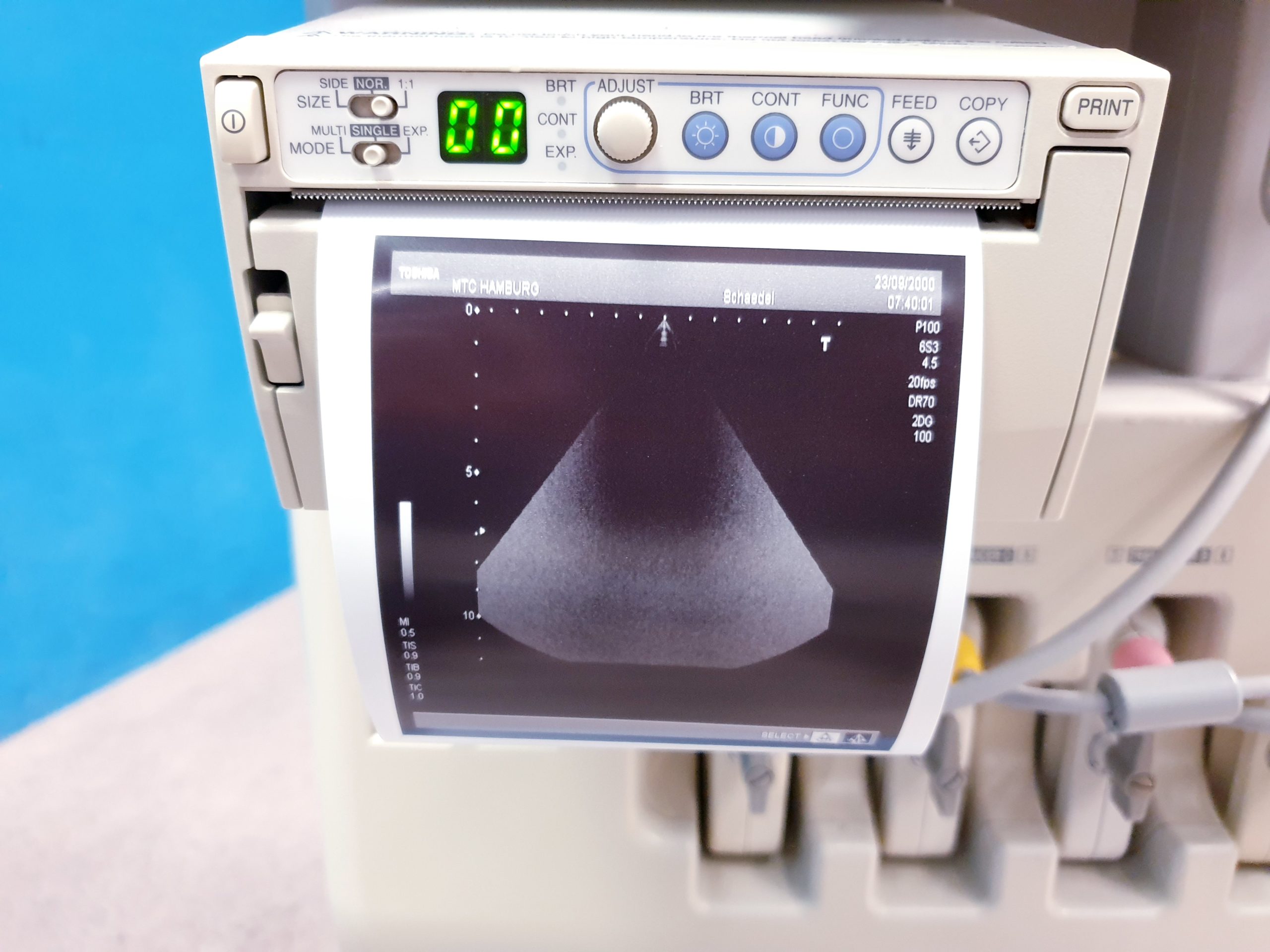 TOSHIBA NEMIO 20 SSA-550A Farbdoppler Ultraschallgerät mit 4 Sonden – und Printer thumbnail 12