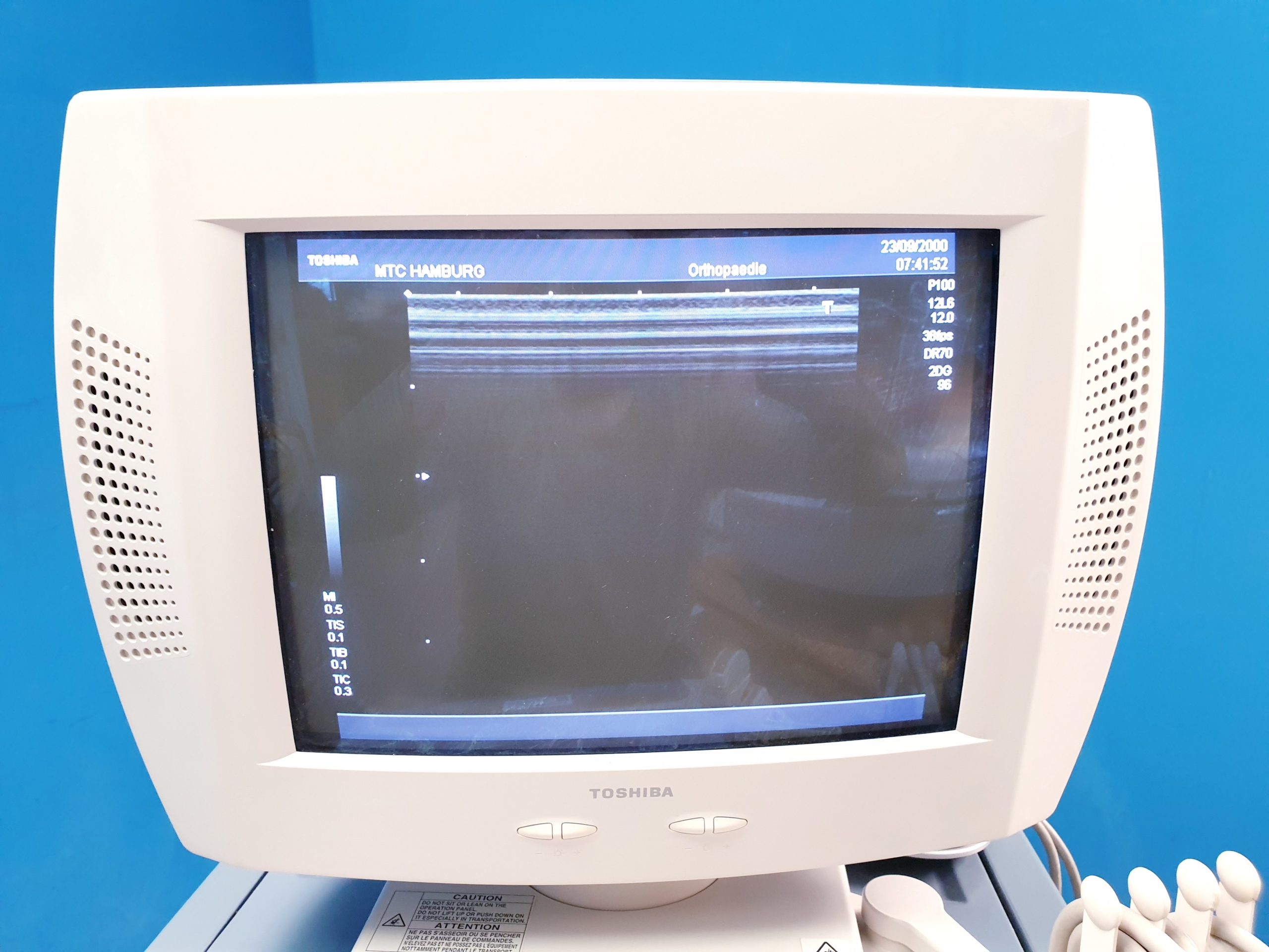 TOSHIBA NEMIO 20 SSA-550A Farbdoppler Ultraschallgerät mit 4 Sonden – und Printer thumbnail 16