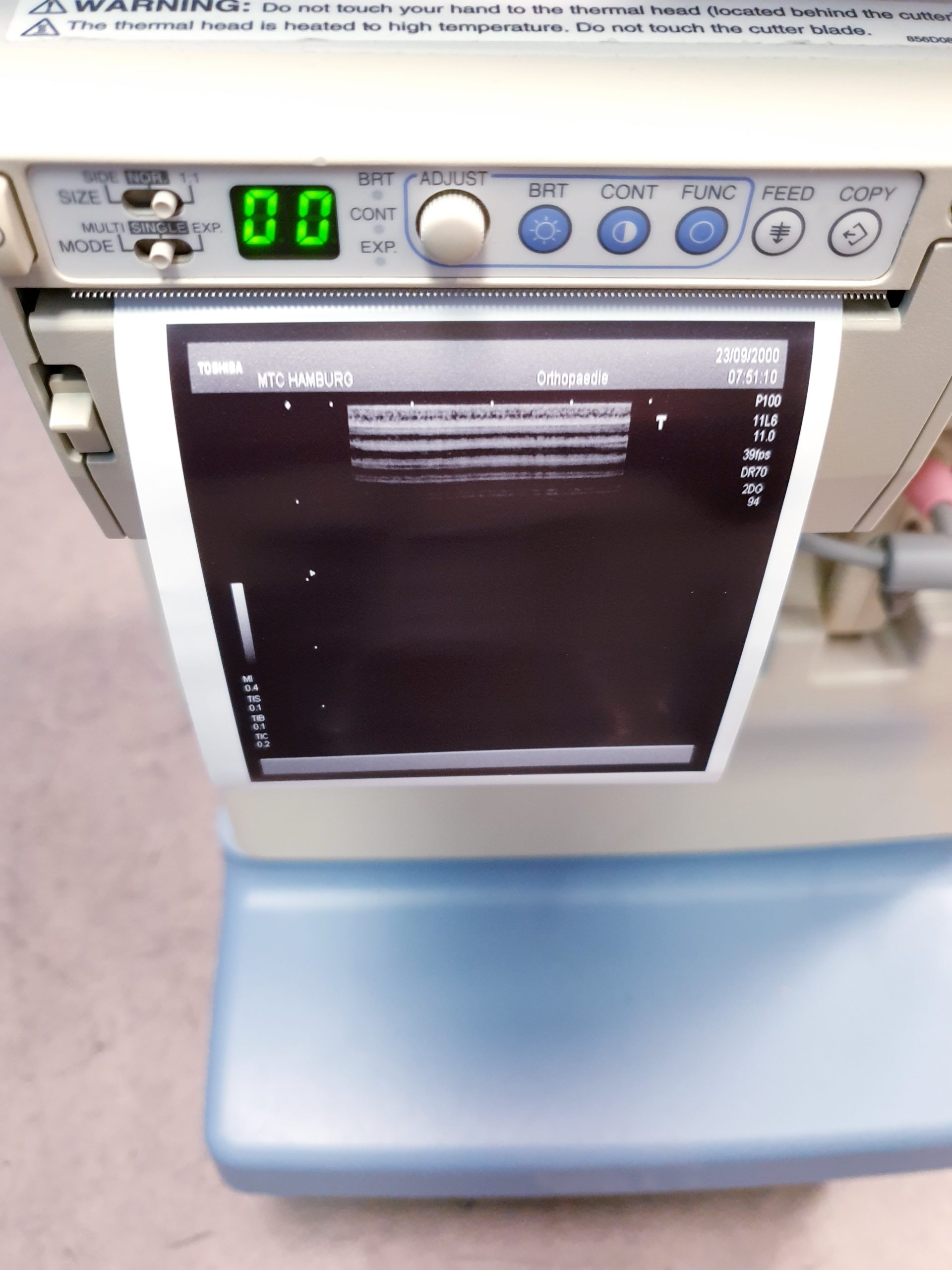 TOSHIBA NEMIO 20 SSA-550A Farbdoppler Ultraschallgerät mit 4 Sonden – und Printer thumbnail 21