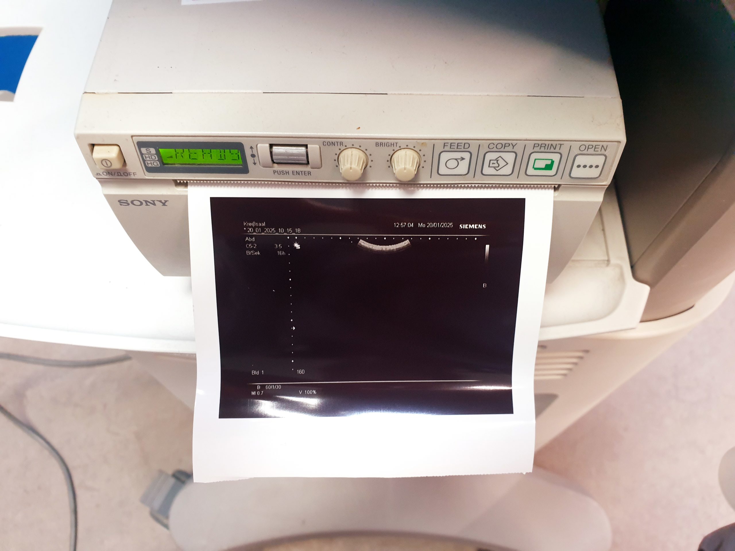 Siemens C5-2 Ultraschall Ultrasound Probe Sonde – defekt thumbnail 4