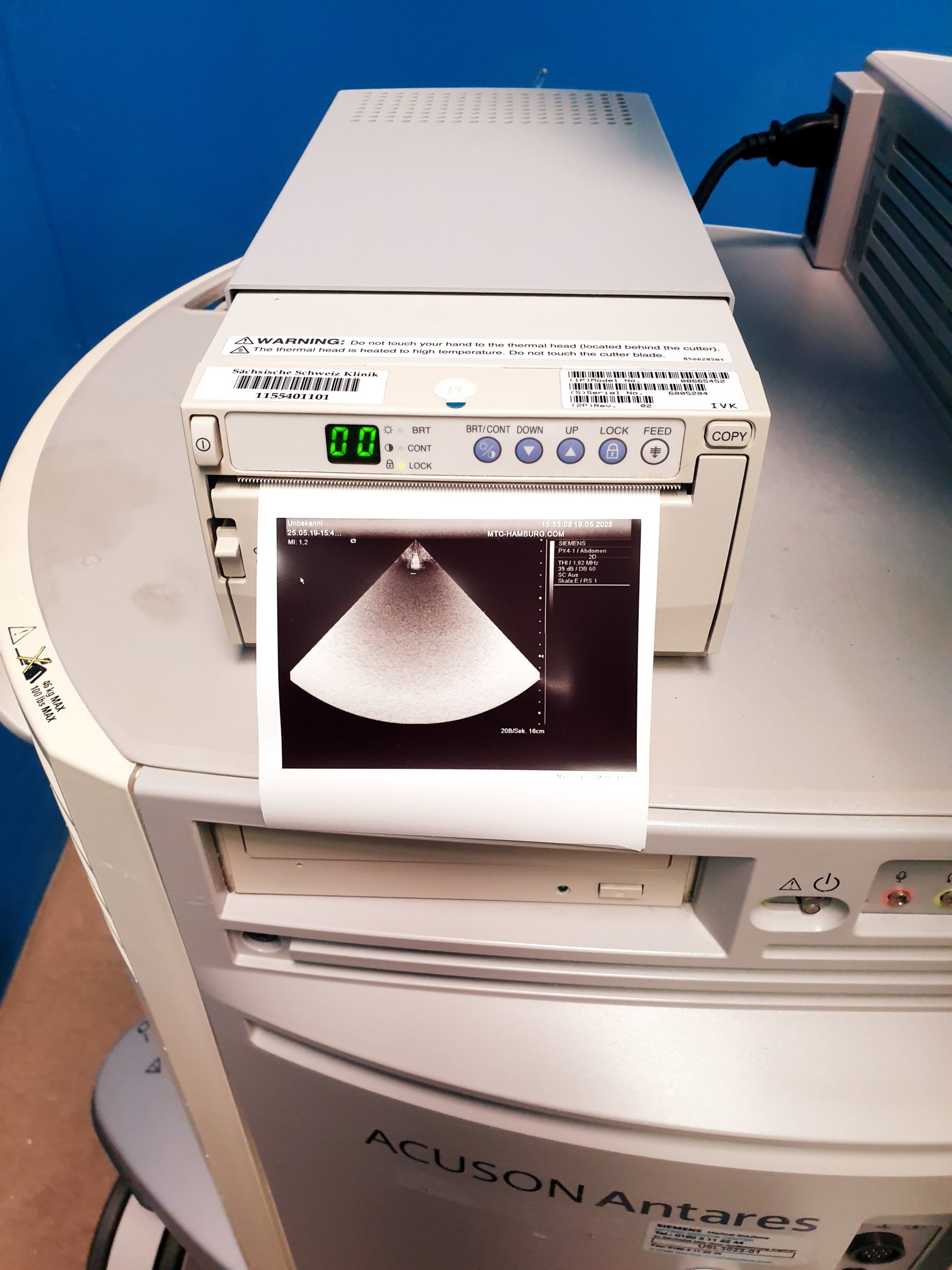 Siemens Acuson Antares Fahrdoppler Doppler + CH4-1 + VFX10-5 + PX4-1 Kardio thumbnail 8