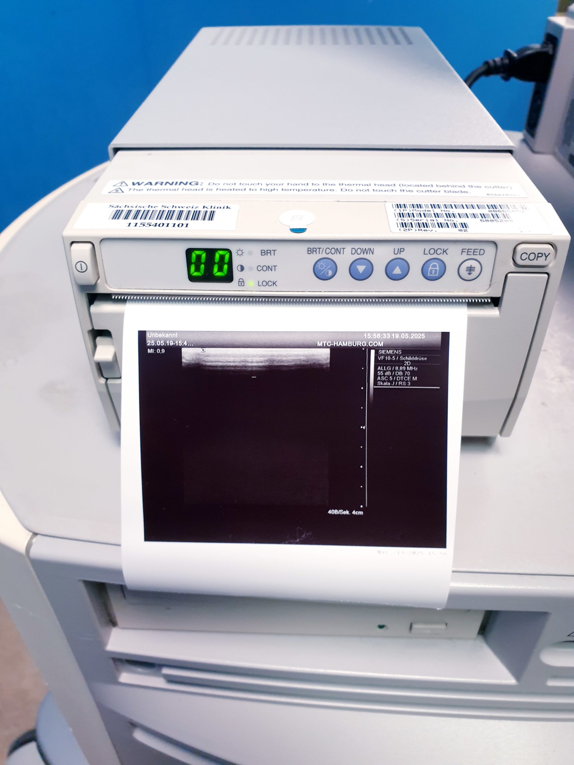 Siemens Acuson Antares Fahrdoppler Doppler + CH4-1 + VFX10-5 + PX4-1 Kardio thumbnail 12