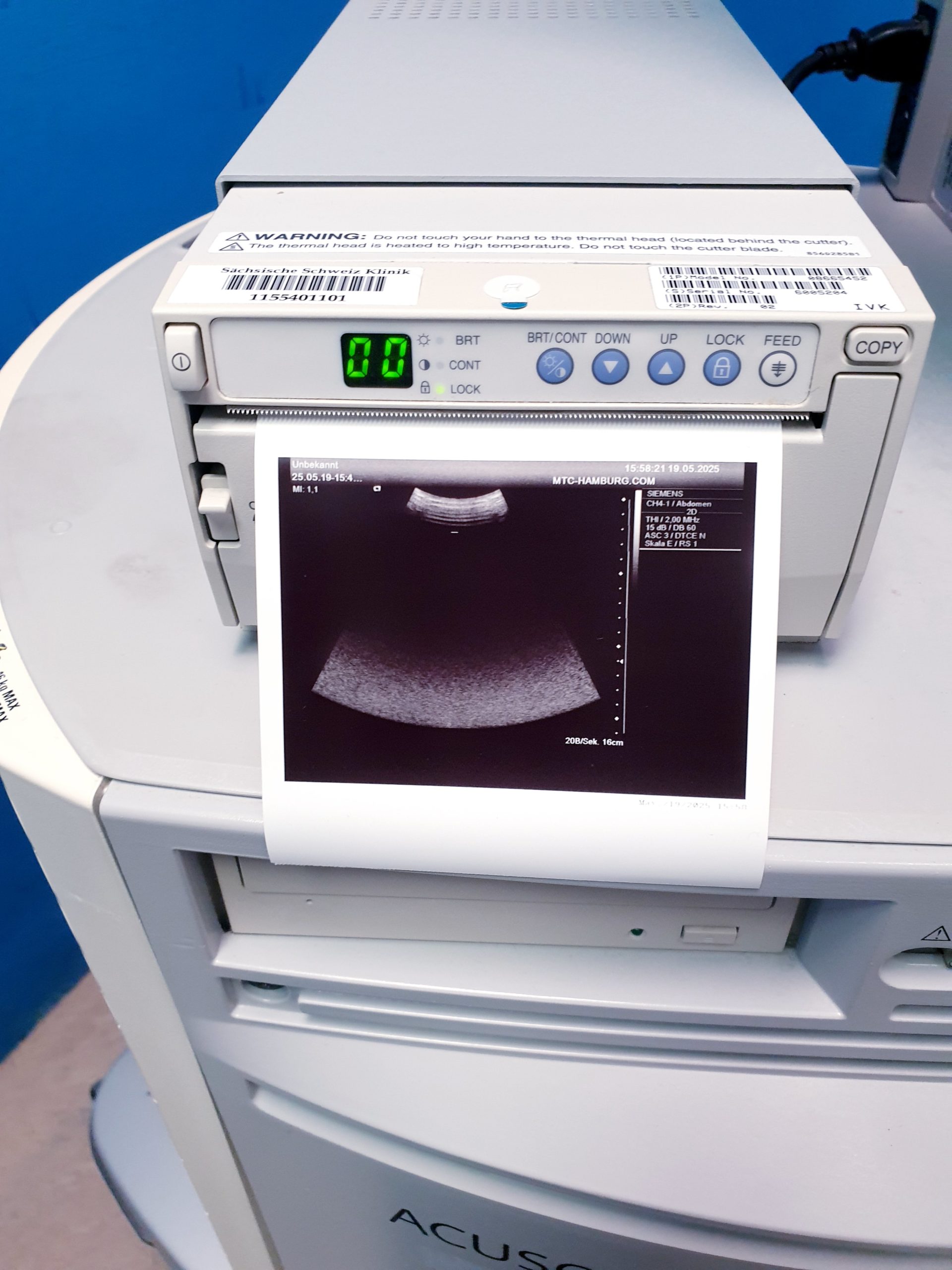 Siemens Acuson Antares Fahrdoppler Doppler + CH4-1 + VFX10-5 + PX4-1 Kardio thumbnail 16