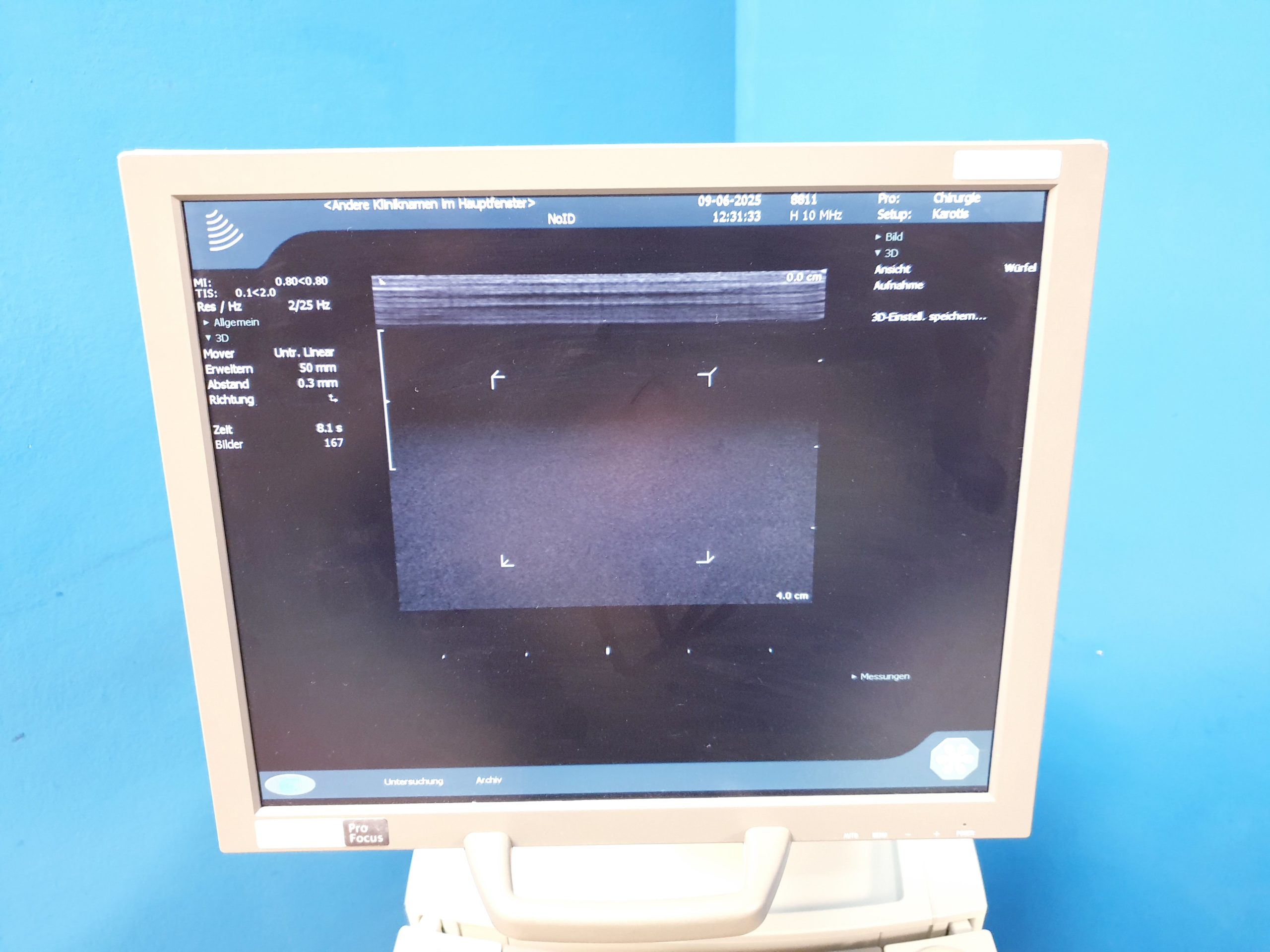 BK MEDICAL Pro Focus 2202 + 8811 Linear + 8820e Konvex Sonde thumbnail 6