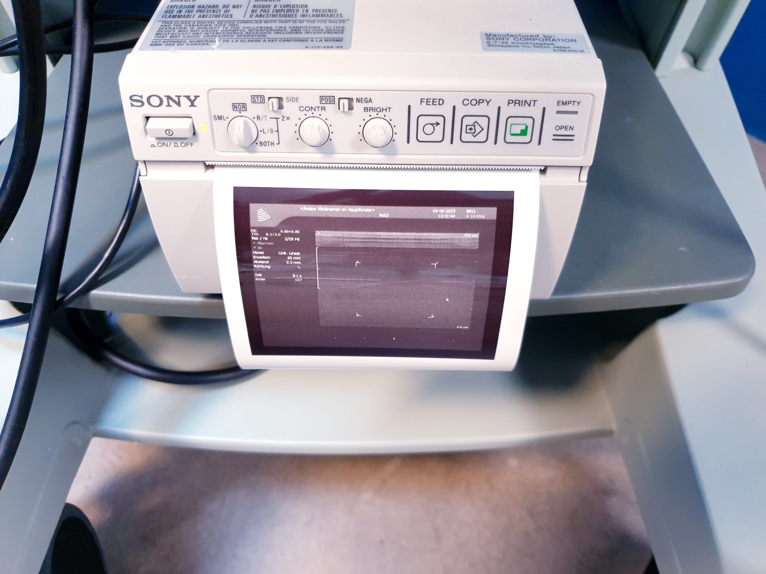 BK MEDICAL Pro Focus 2202 + 8811 Linear + 8820e Konvex Sonde thumbnail 7