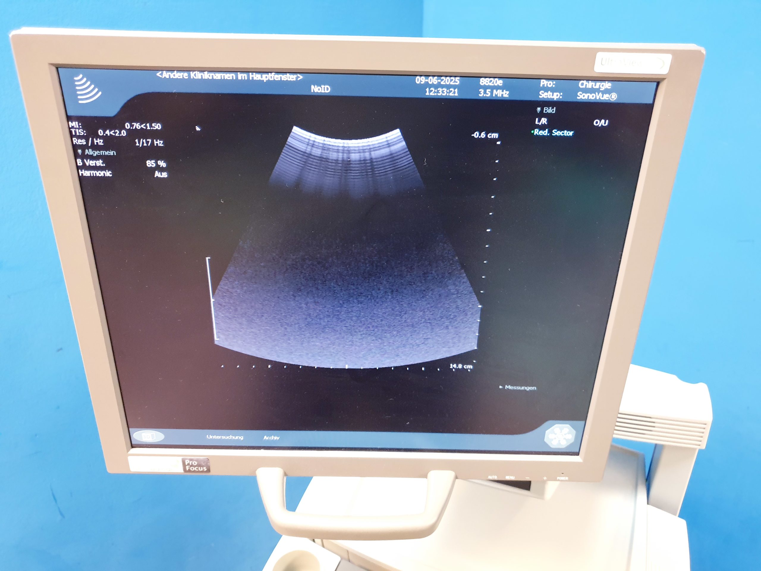 BK MEDICAL Pro Focus 2202 + 8811 Linear + 8820e Konvex Sonde thumbnail 10