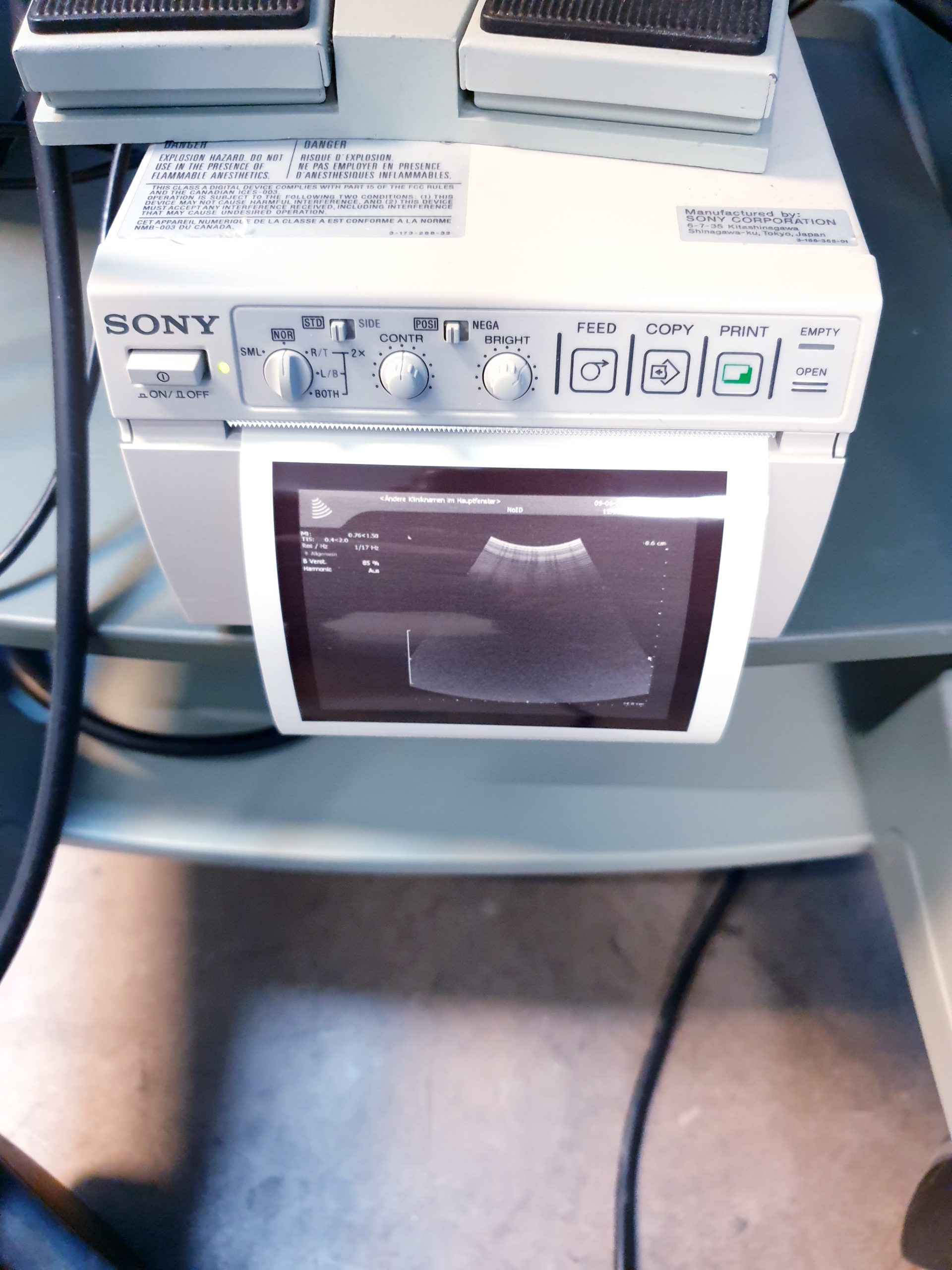BK MEDICAL Pro Focus 2202 + 8811 Linear + 8820e Konvex Sonde thumbnail 11