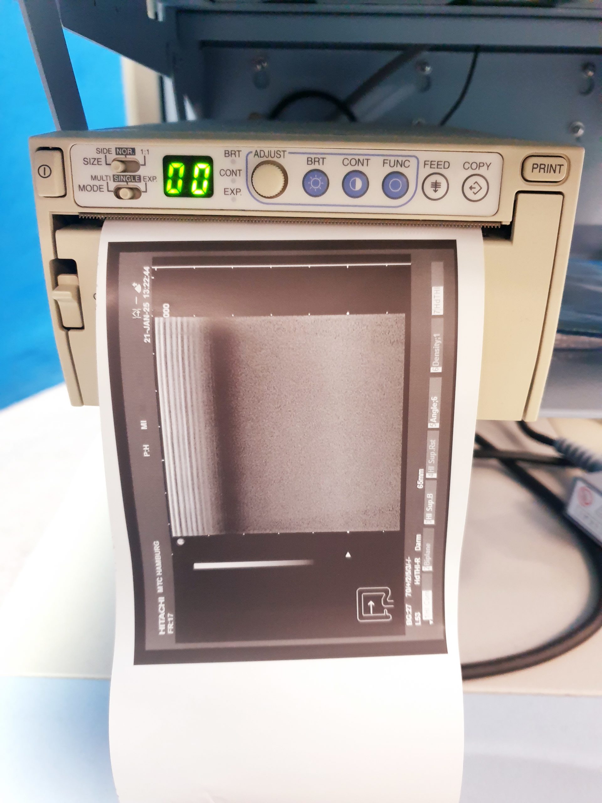 Hitachi EUP-L53 Lineare Sonde thumbnail 3