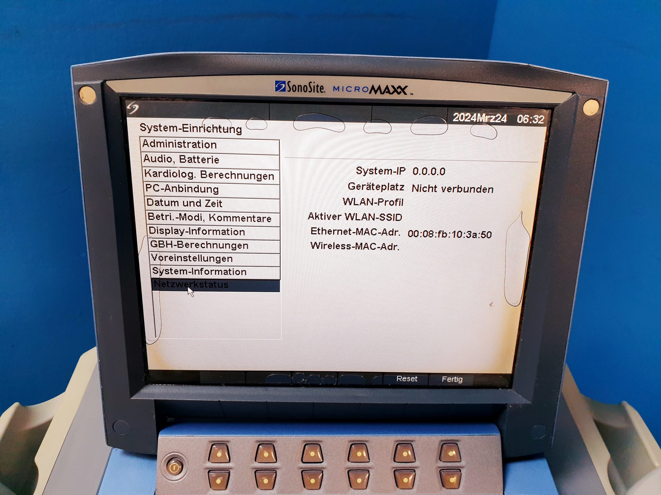 Sonosite MicroMaxx + L25e13-6 MHz + L38e10-5 MHz + P17 5-1MHz thumbnail 19