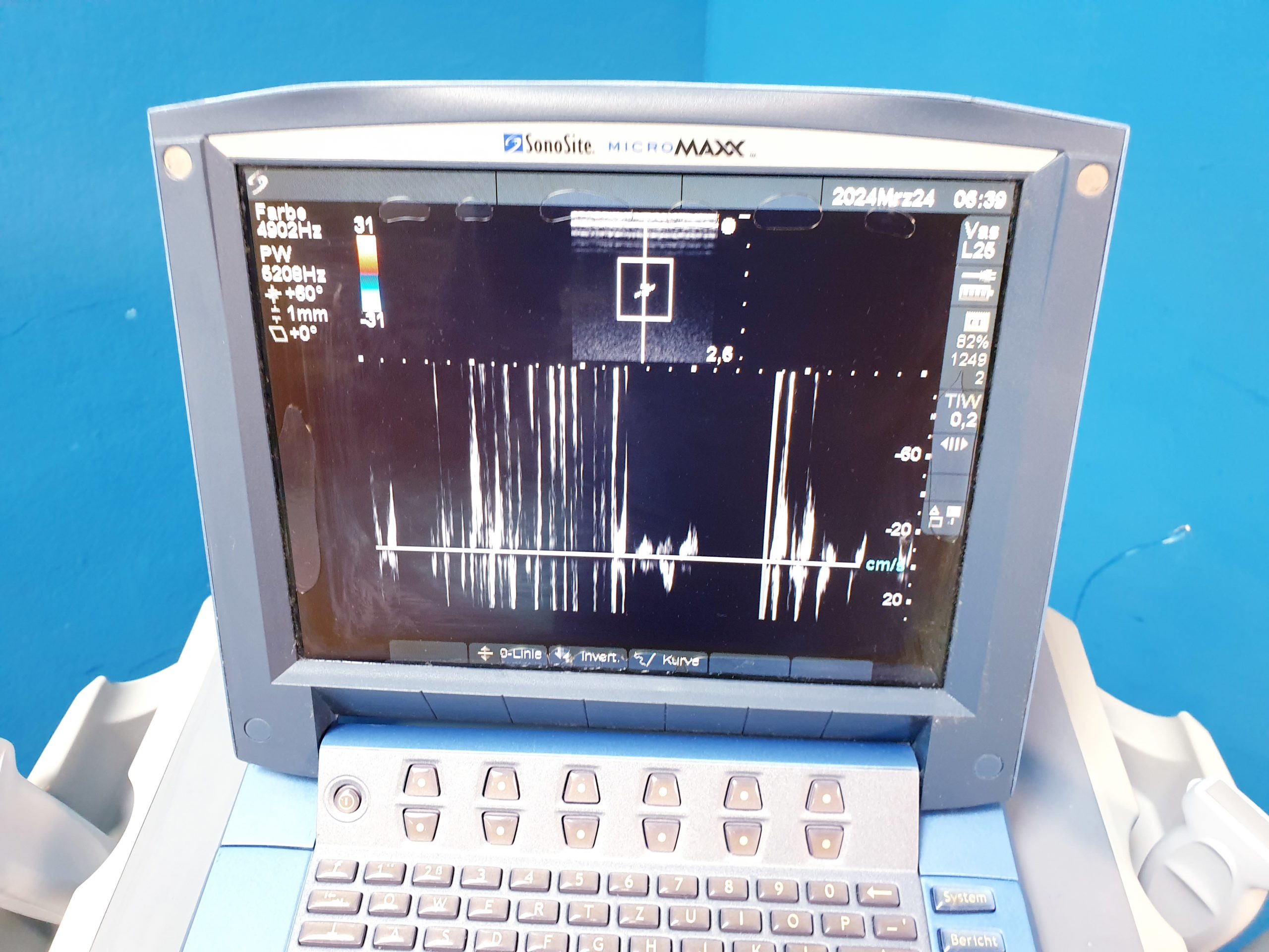 Sonosite MicroMaxx + L25e13-6 MHz + L38e10-5 MHz + P17 5-1MHz thumbnail 23