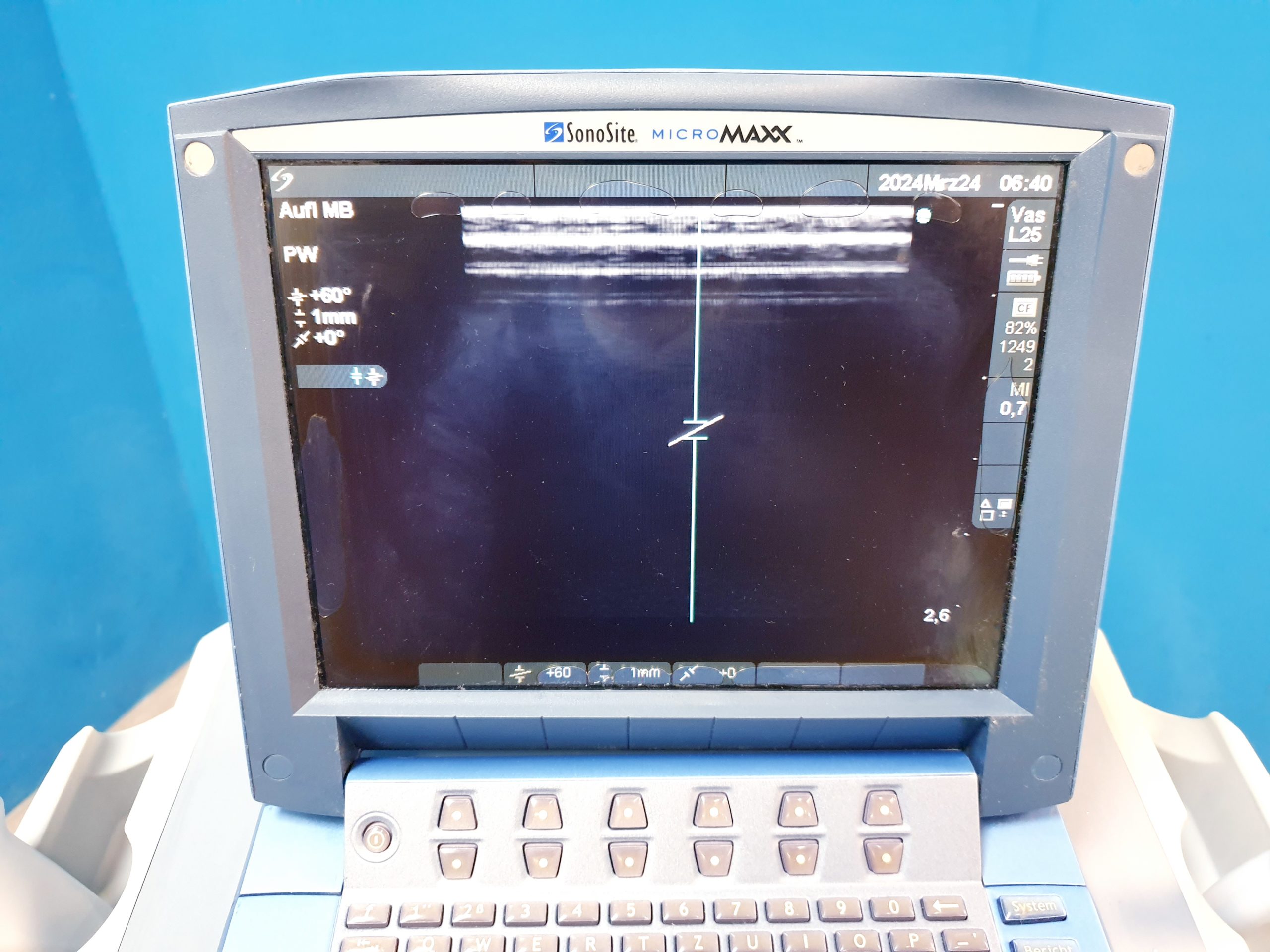 Sonosite MicroMaxx + L25e13-6 MHz + L38e10-5 MHz + P17 5-1MHz thumbnail 26