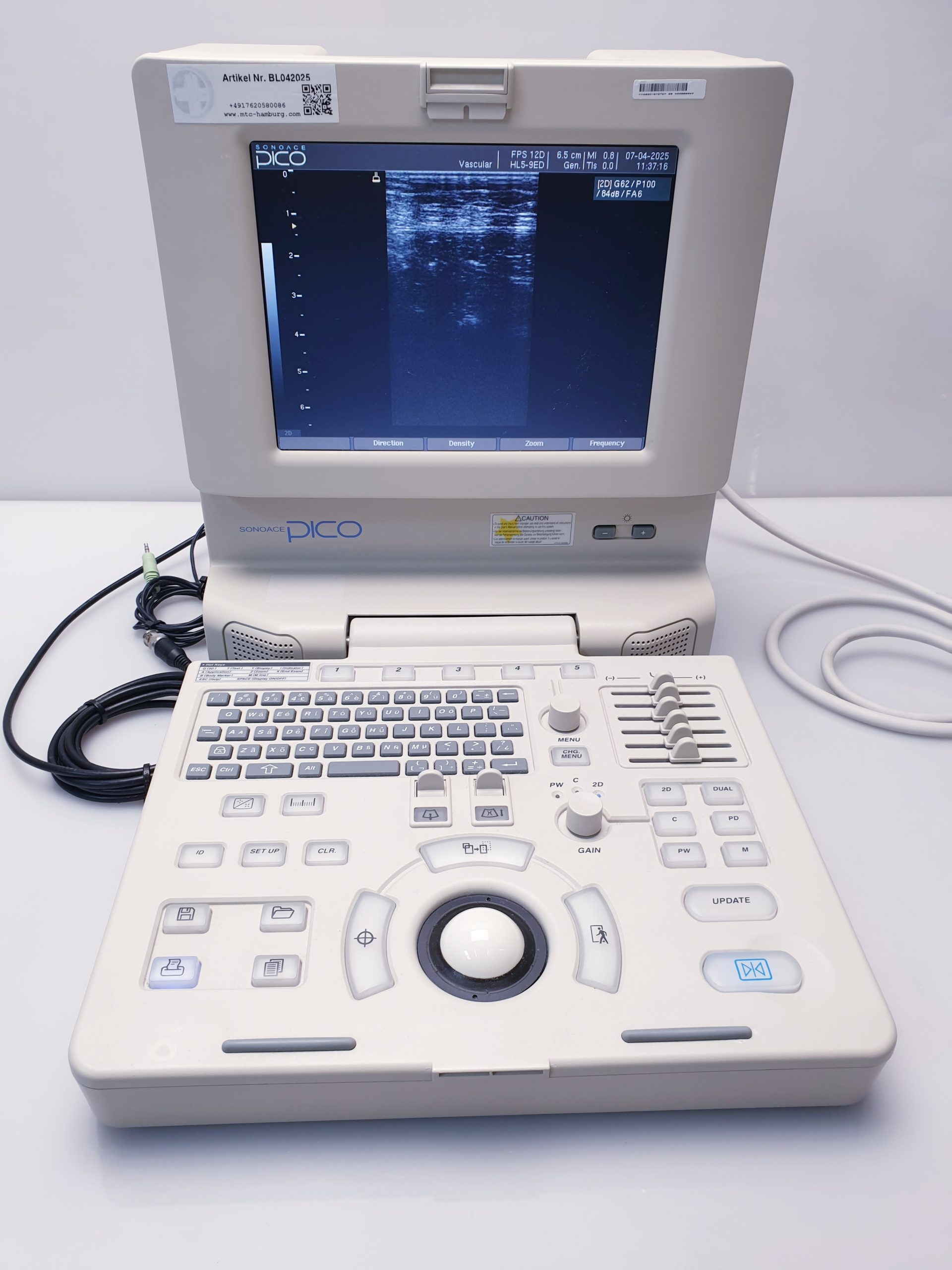 Medison SonoAce PICO tragbarer Ultraschall + C3-7ED Konvex + HL5-9ED Linear thumbnail 15