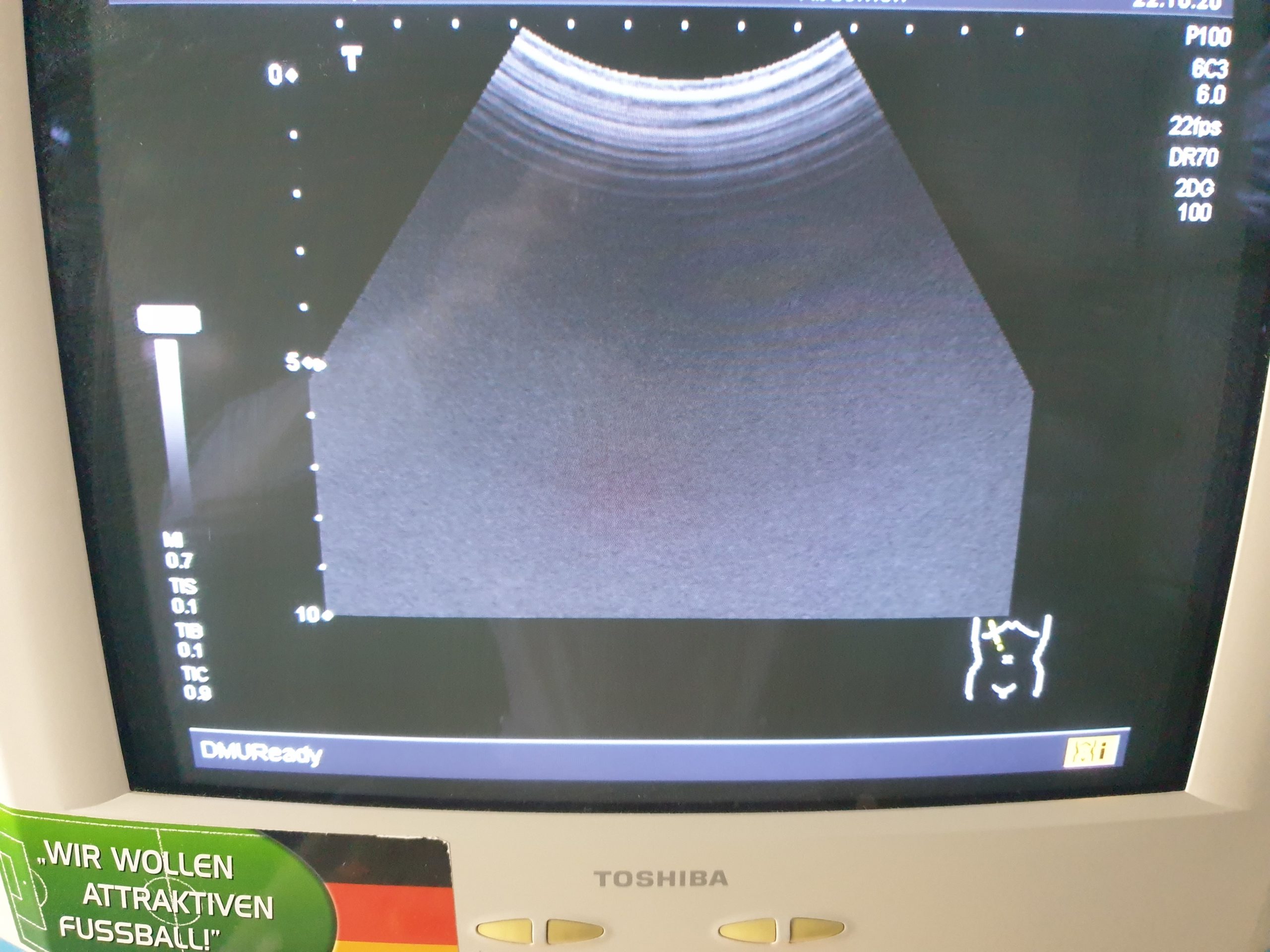 Toshiba Nemio SSA-550A mit Konvex und Linear Sonde thumbnail 3