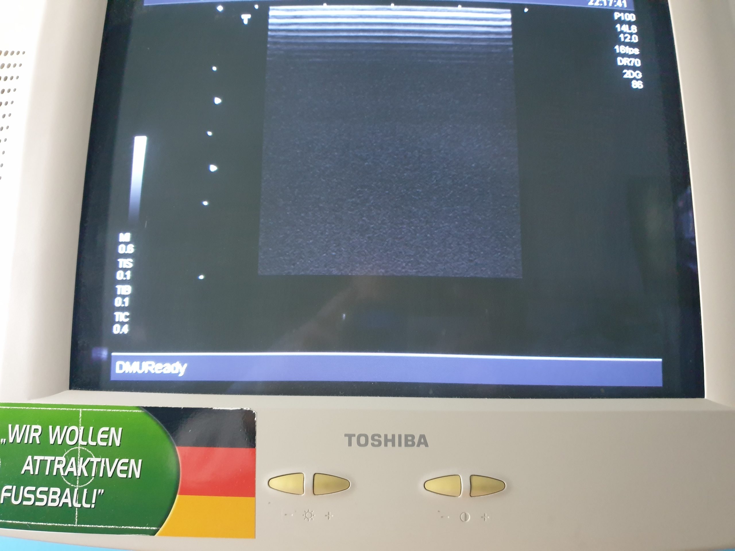 Toshiba Nemio SSA-550A mit Konvex und Linear Sonde thumbnail 5
