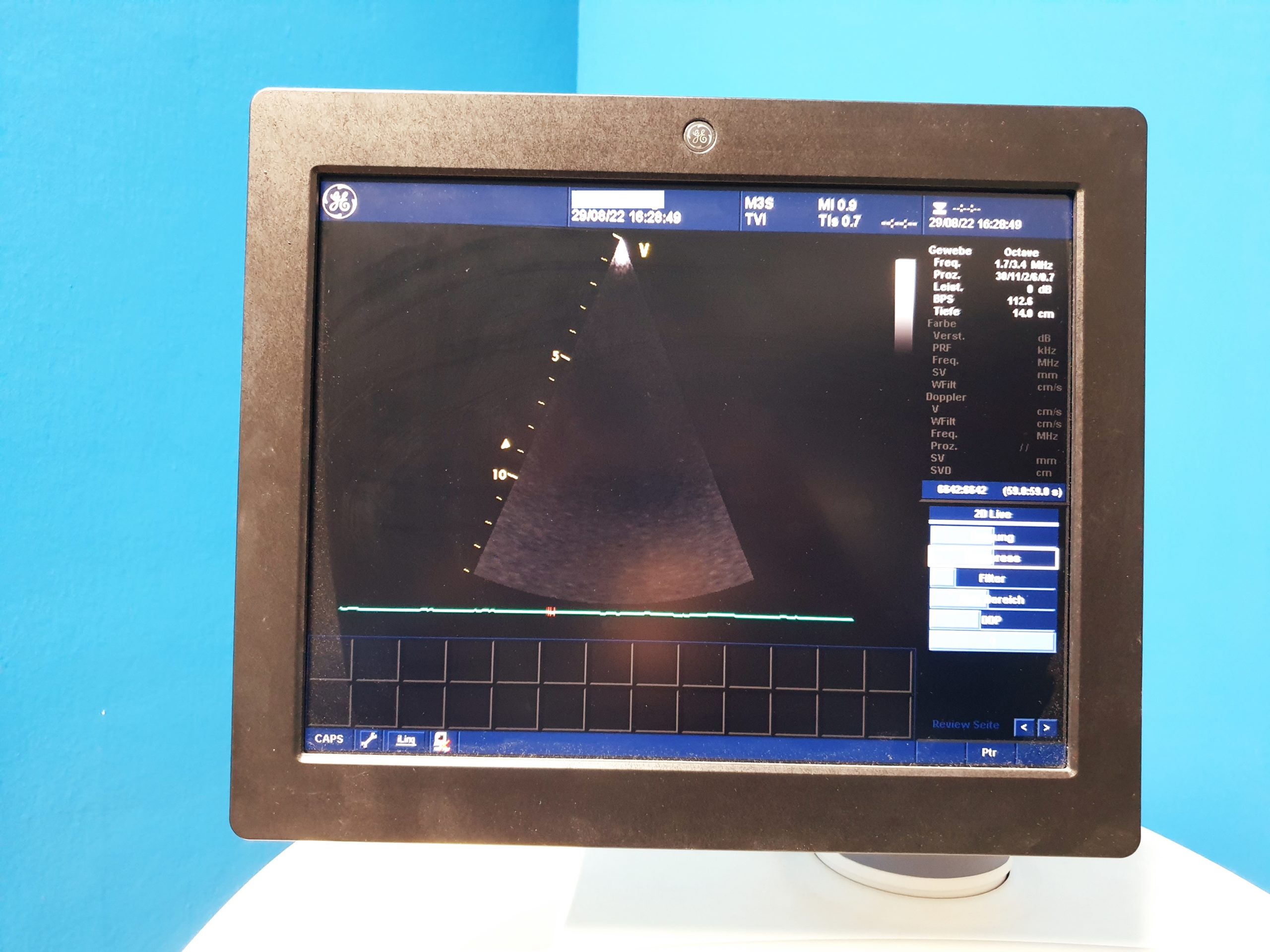 GE Vivid 7 Dimension mit GE M3S Echo Kardio Sonde und 7L Linear SW: 2.0.6 Application SW: 5.2.0 thumbnail 3