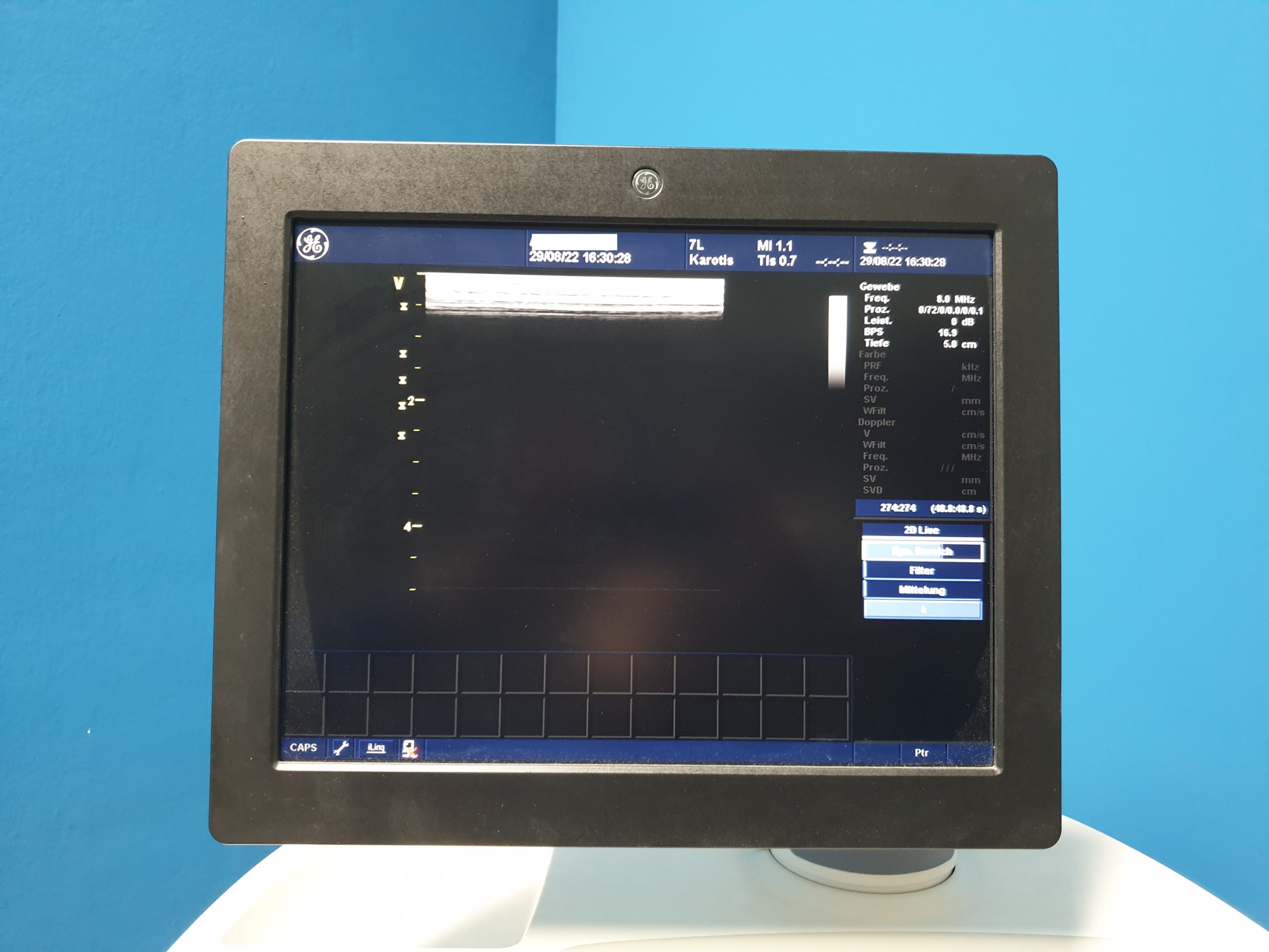 GE Vivid 7 Dimension mit GE M3S Echo Kardio Sonde und 7L Linear SW: 2.0.6 Application SW: 5.2.0 thumbnail 5