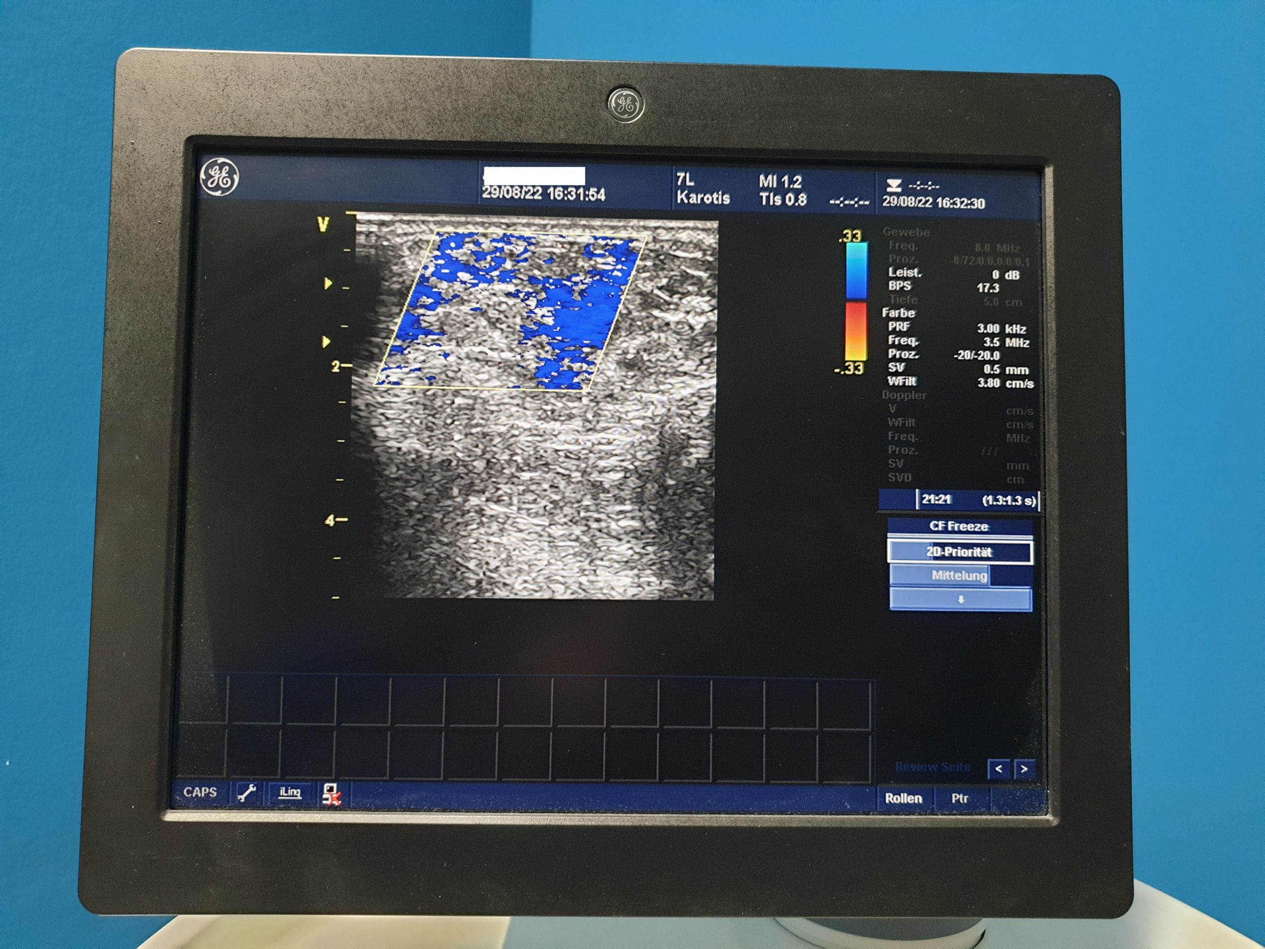 GE Vivid 7 Dimension mit GE M3S Echo Kardio Sonde und 7L Linear SW: 2.0.6 Application SW: 5.2.0 thumbnail 6