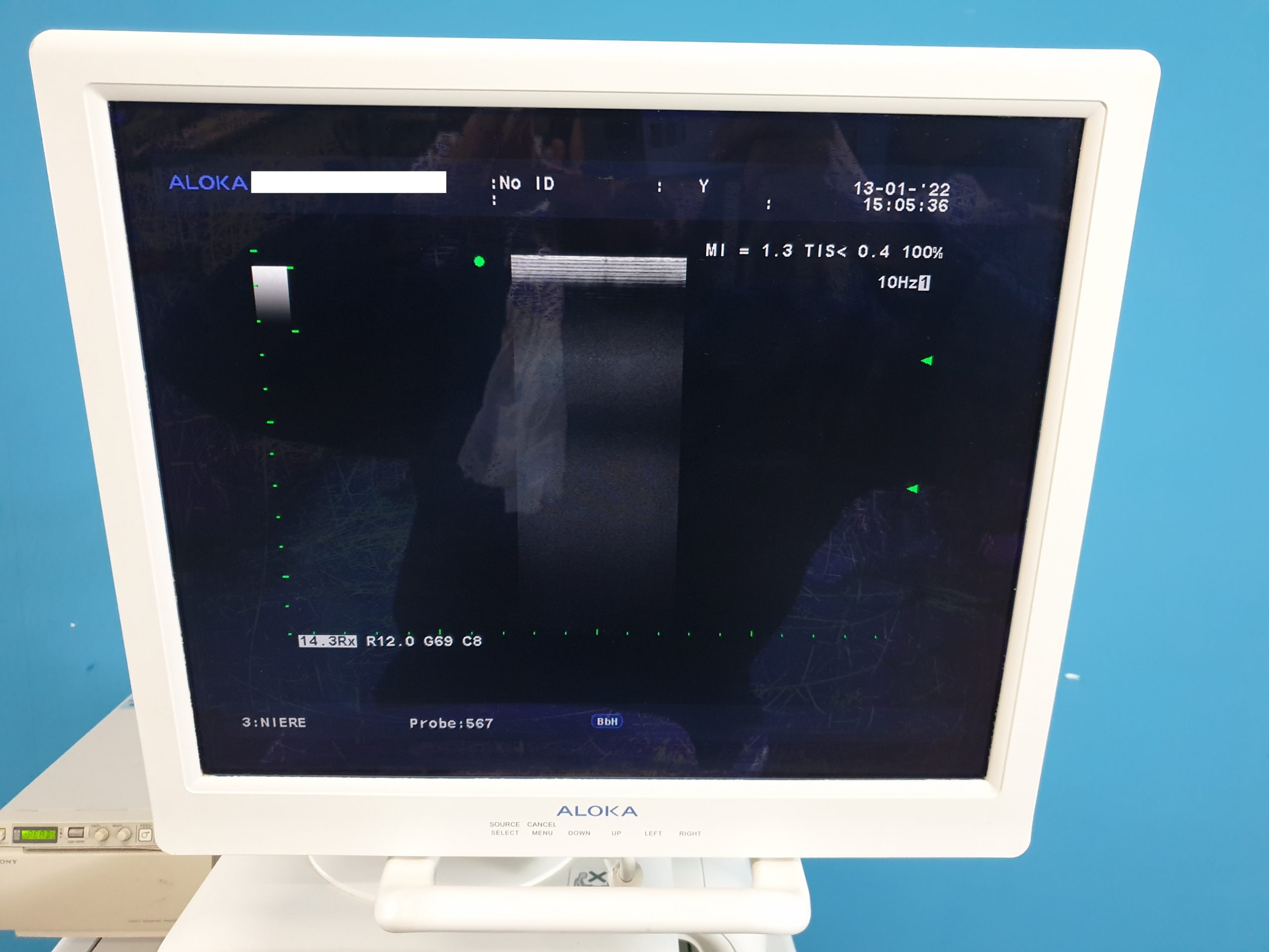 Aloka Prosound Alfa 10 Farbdoppler mit Konvex, Linear und Printer , thumbnail 3