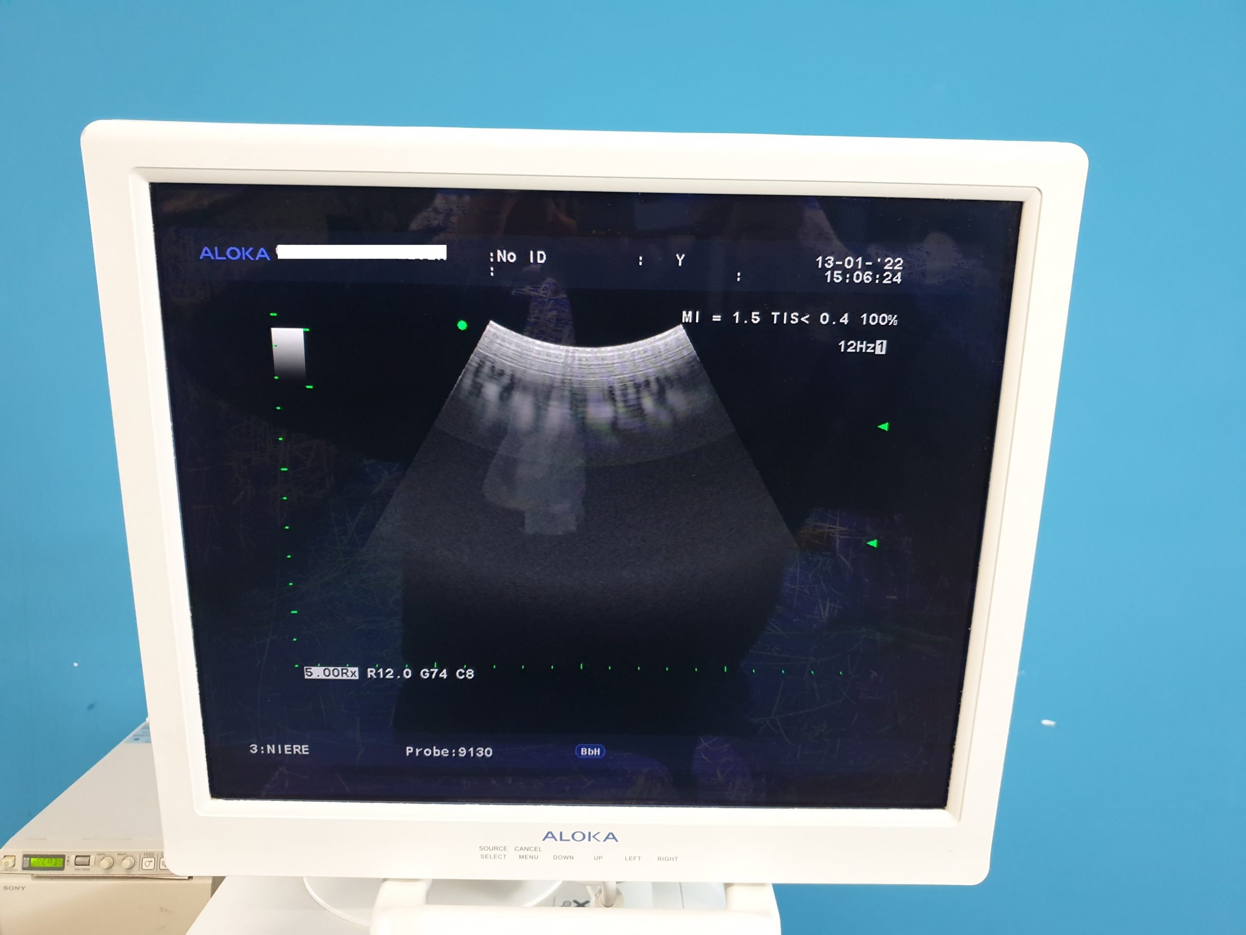 Aloka Prosound Alfa 10 Farbdoppler mit Konvex, Linear und Printer , thumbnail 5