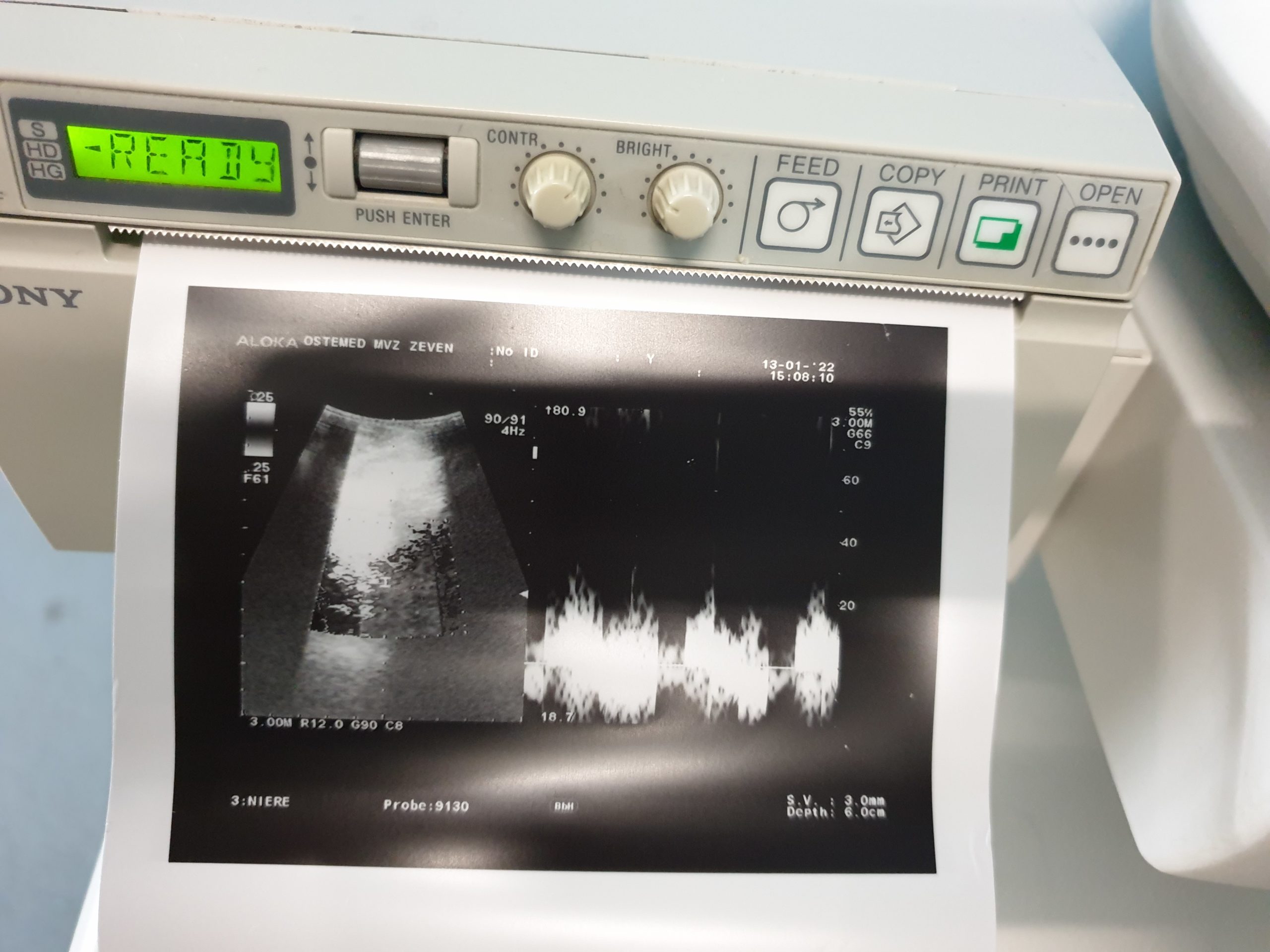 Aloka Prosound Alfa 10 Farbdoppler mit Konvex, Linear und Printer , thumbnail 7