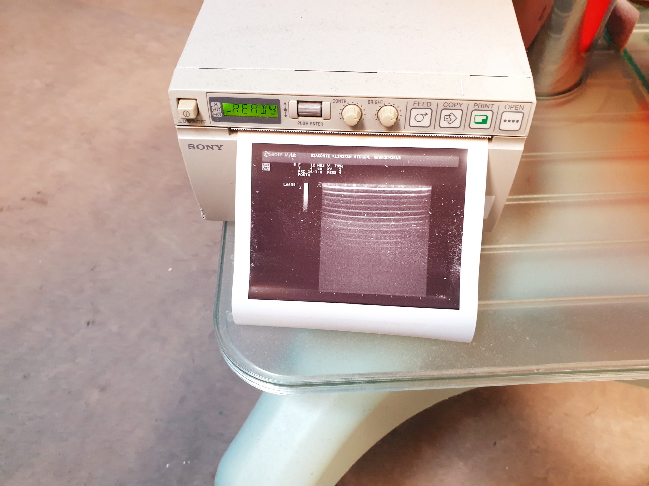 Esaote LA435 Linear Array Ultrasound Lineare Sonde AH042025-K thumbnail 3