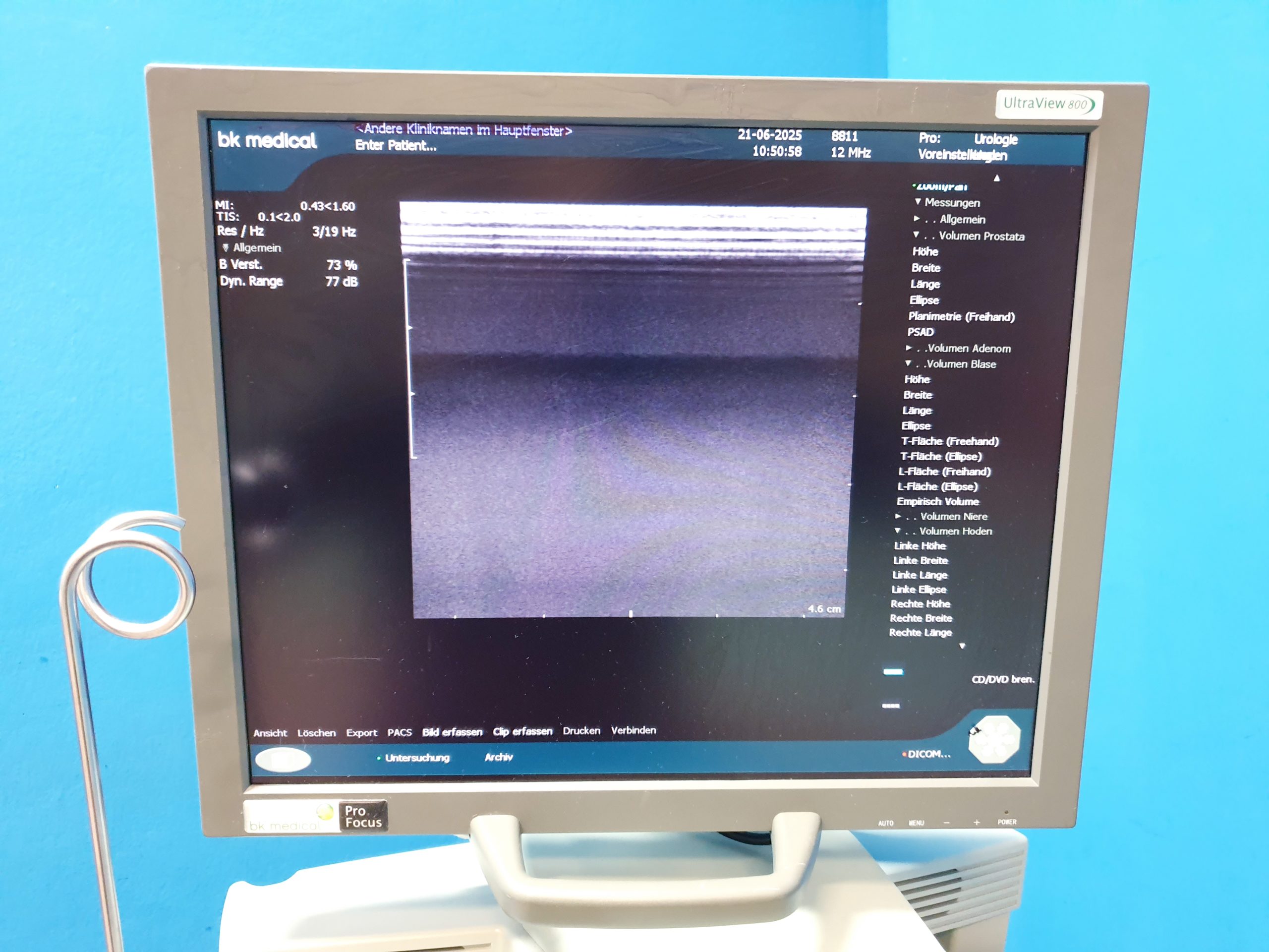 BK Medical 2202 + 8820e Konvex + 8811 Linear Ultraschallgerät thumbnail 10