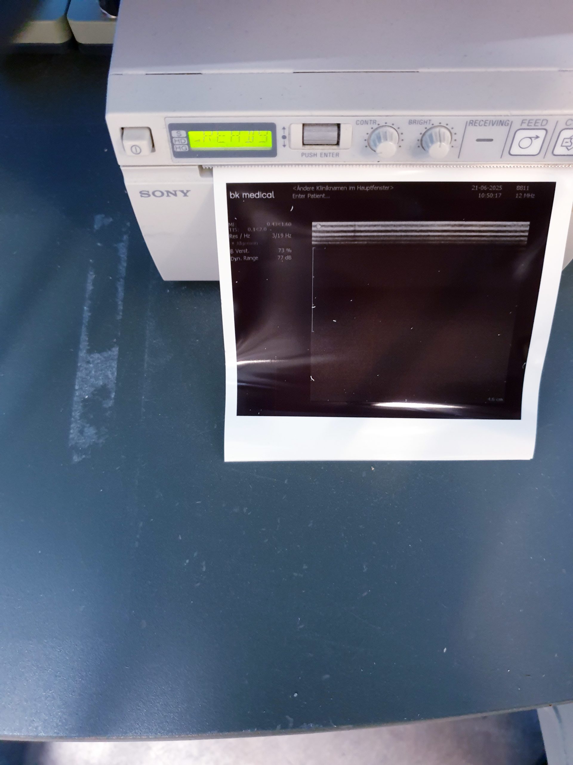 BK Medical 2202 + 8820e Konvex + 8811 Linear Ultraschallgerät thumbnail 11