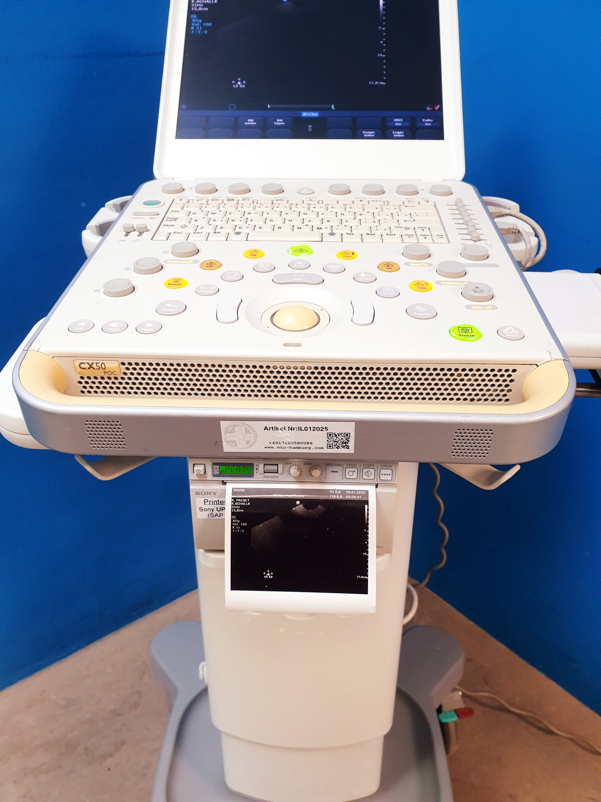Philips CX50 diagnostic Ultrasound kardiomaschine Ohne Sonden thumbnail 2