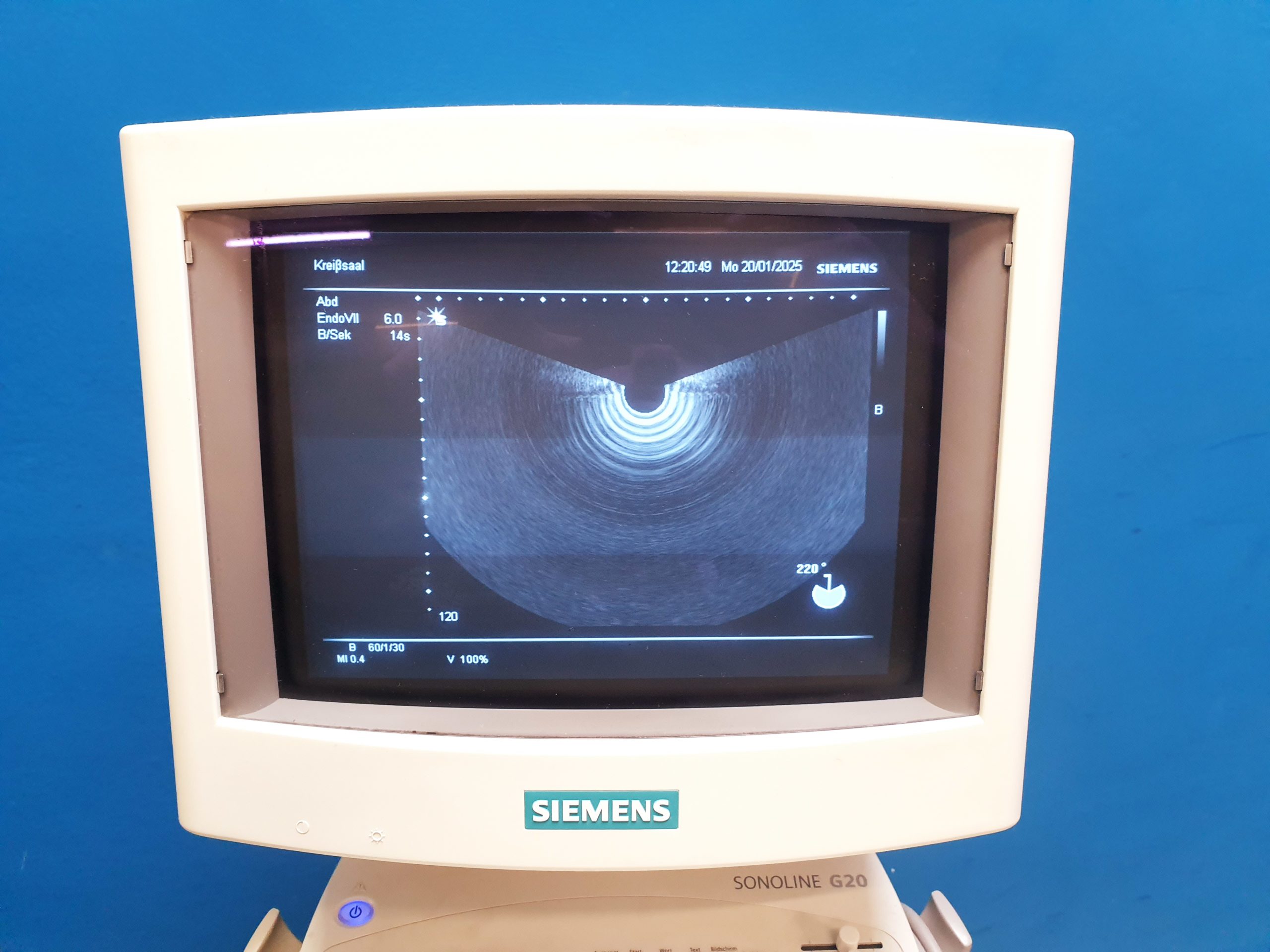 Siemens Endo V-II Ultrasound Endokavitärsonde thumbnail 2