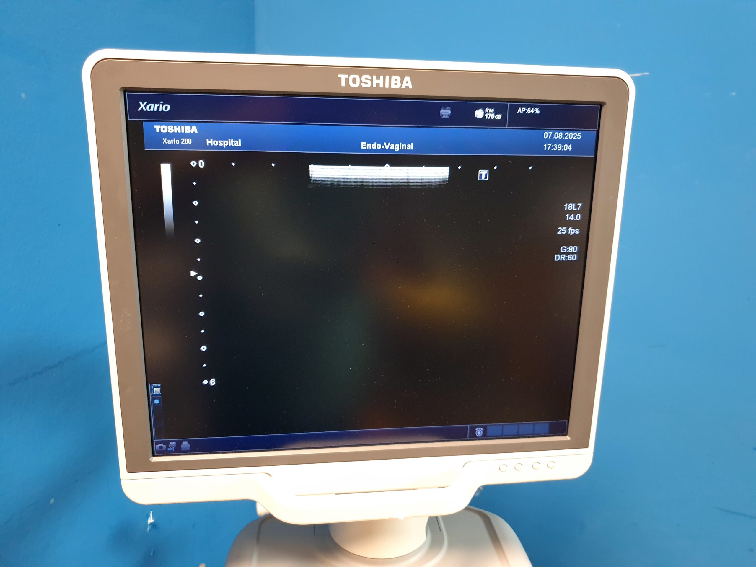 Toshiba XARIO 200 – TUS-X200 + 11C3 + 8CV2 + 18L7 – Gynmaschine DOM 2015 thumbnail 19
