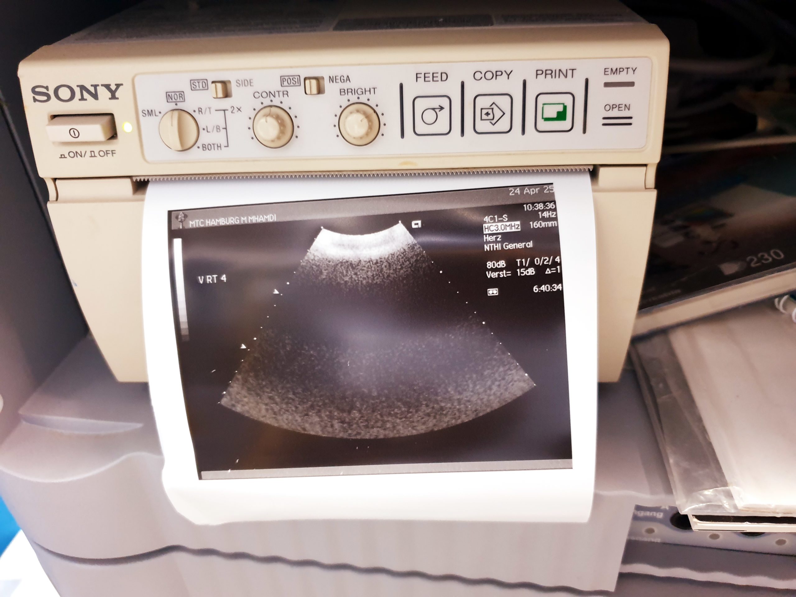 Acuson Siemens 4C1 Ultraschallsonde – Konvex Sonde thumbnail 2