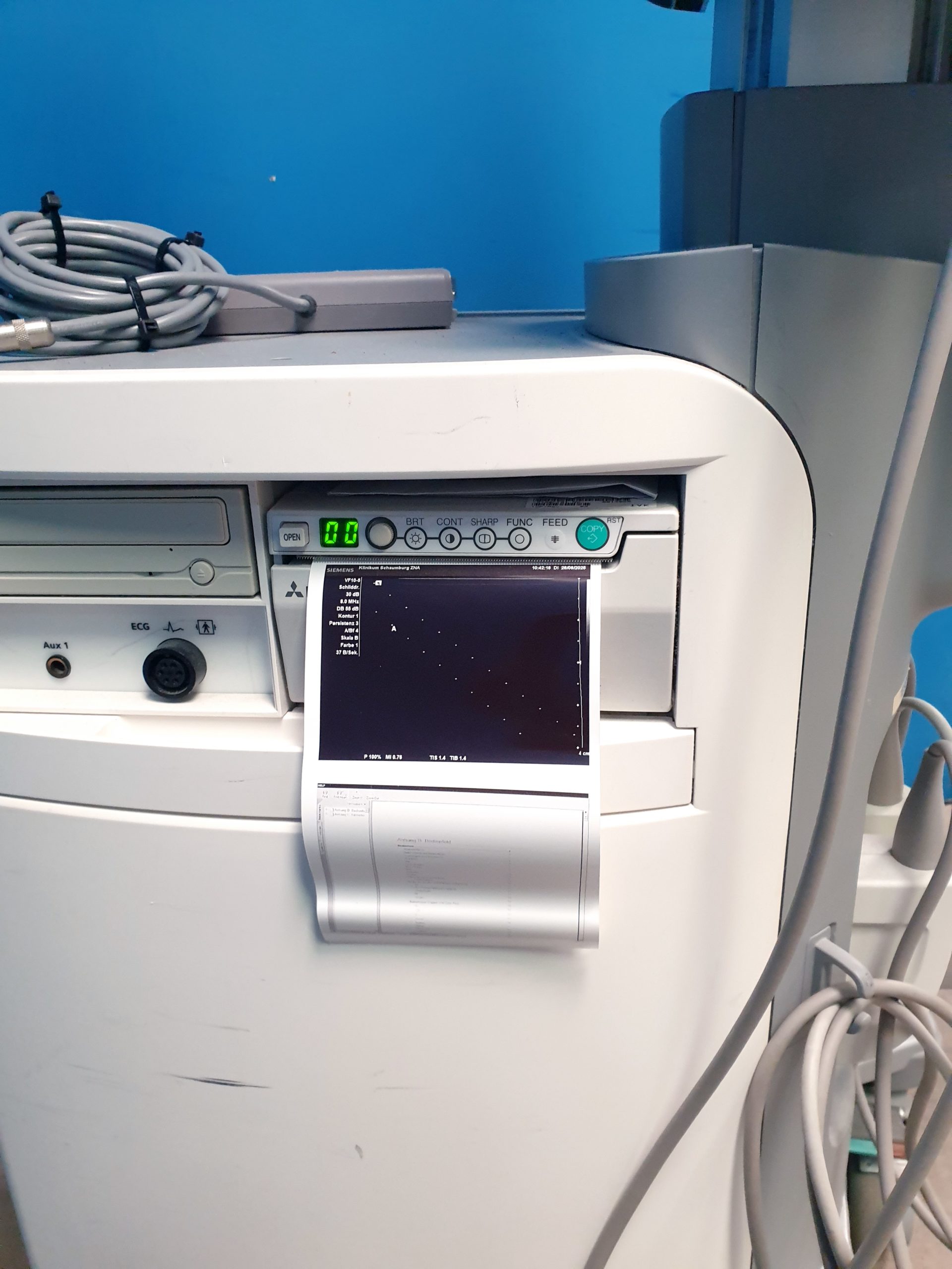 Siemens Accuson X300 + C6-2 + VF10-5 + P5-1 Kardio thumbnail 14