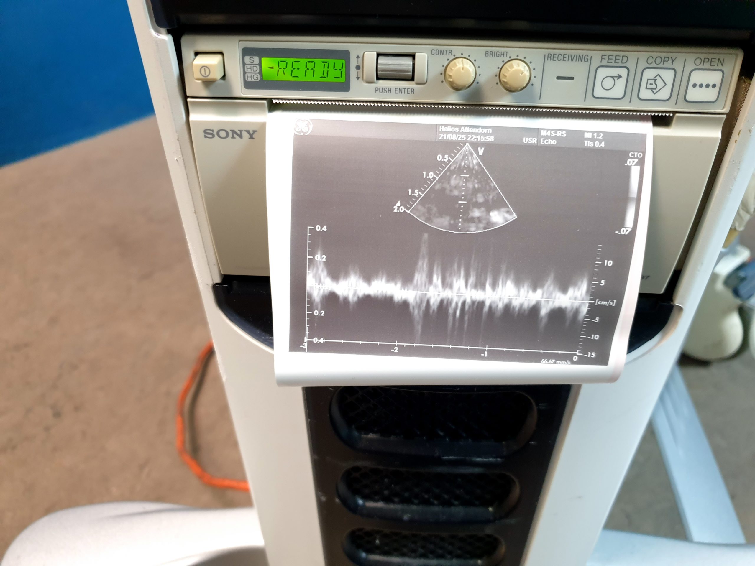 GE Vivid + M4S- RS Kardio Sonde -defekt – Optischer Fehler thumbnail 8